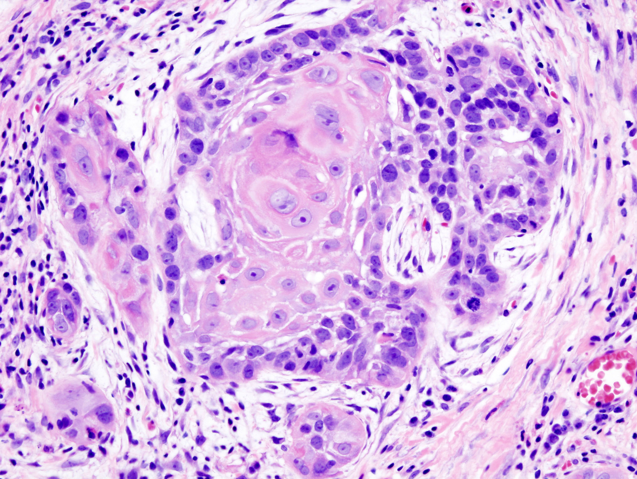‘Eenvoudiger kanker diagnosticeren’