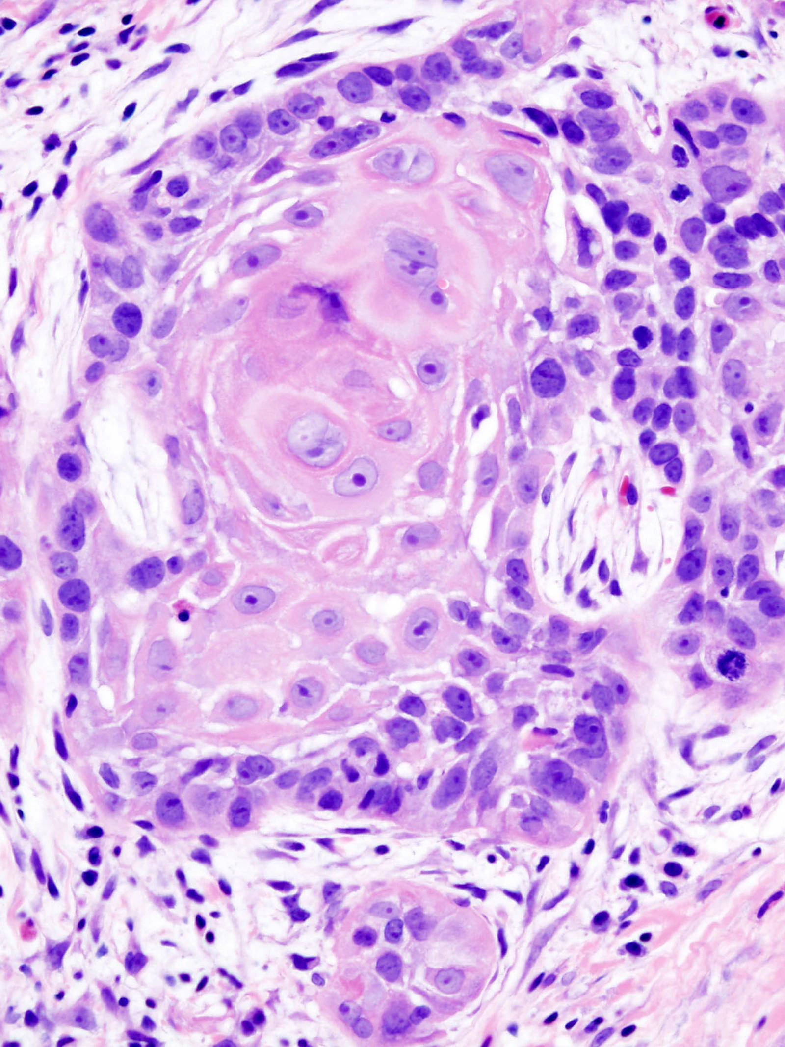 ‘Eenvoudiger kanker diagnosticeren’