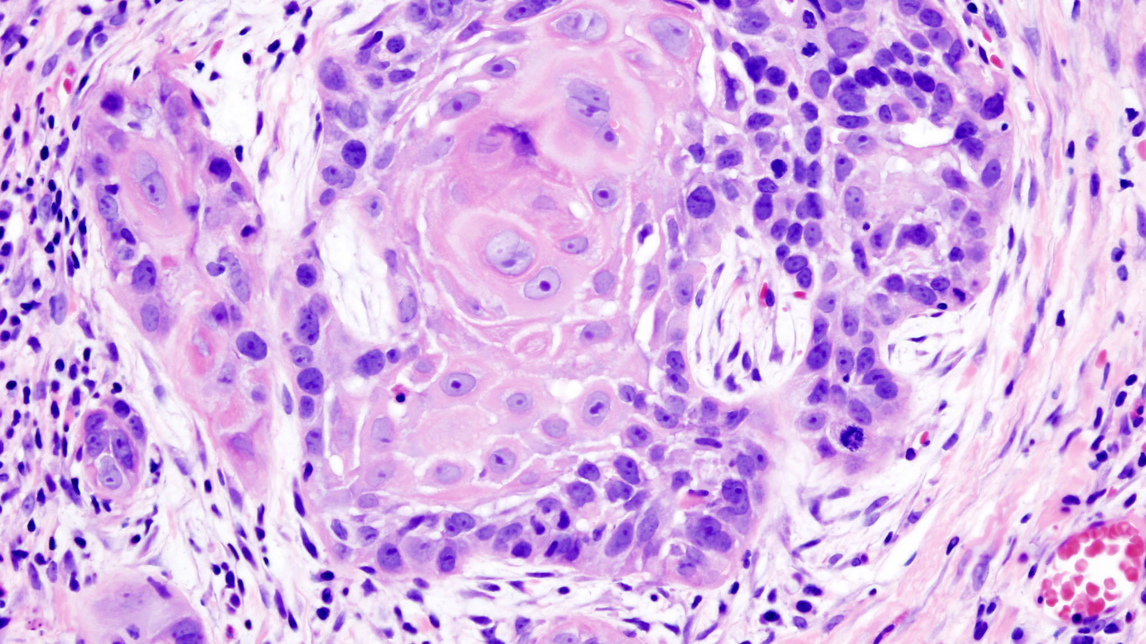 ‘Eenvoudiger kanker diagnosticeren’