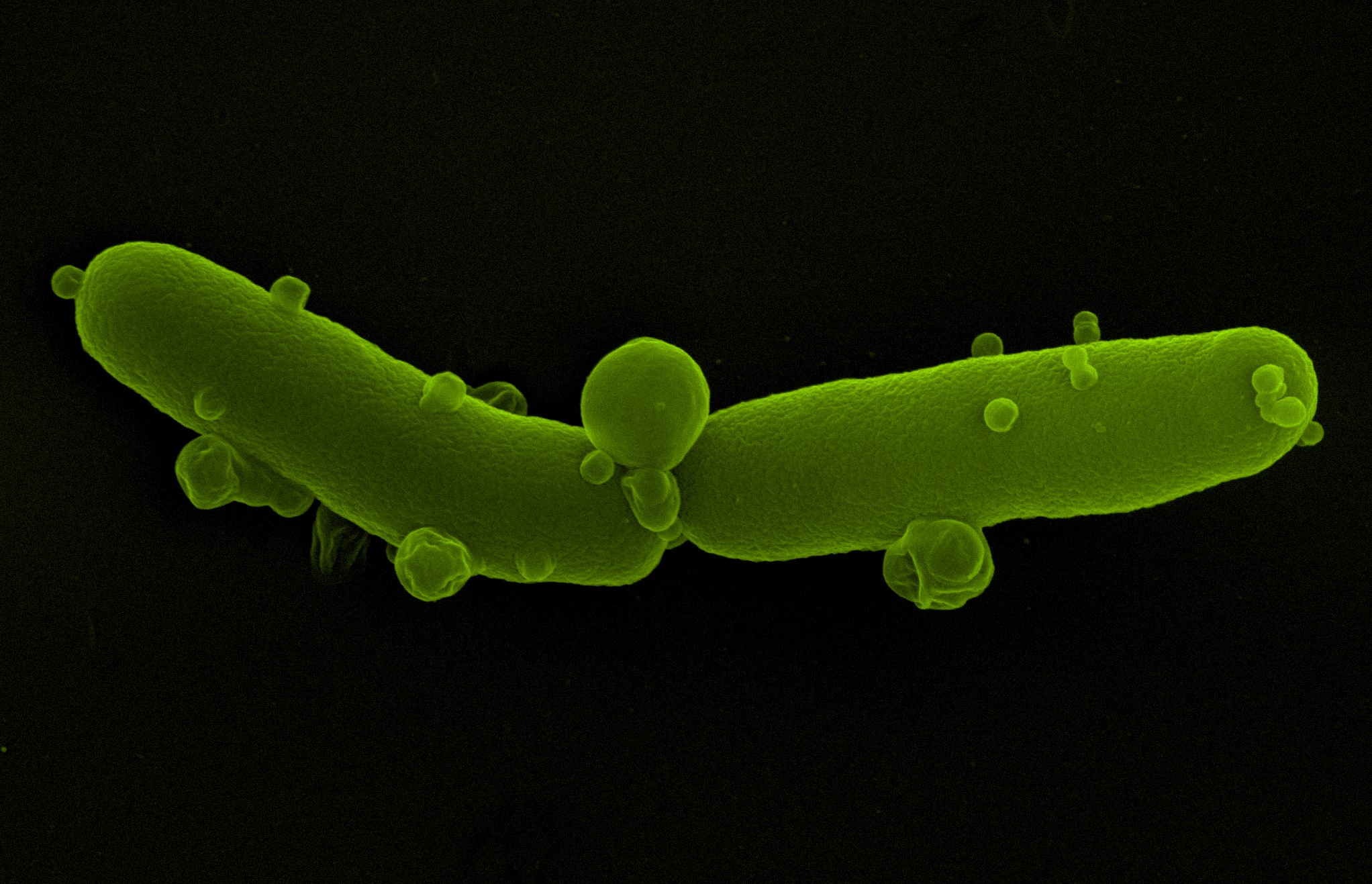 Het gevecht tegen antibioticumresistentie
