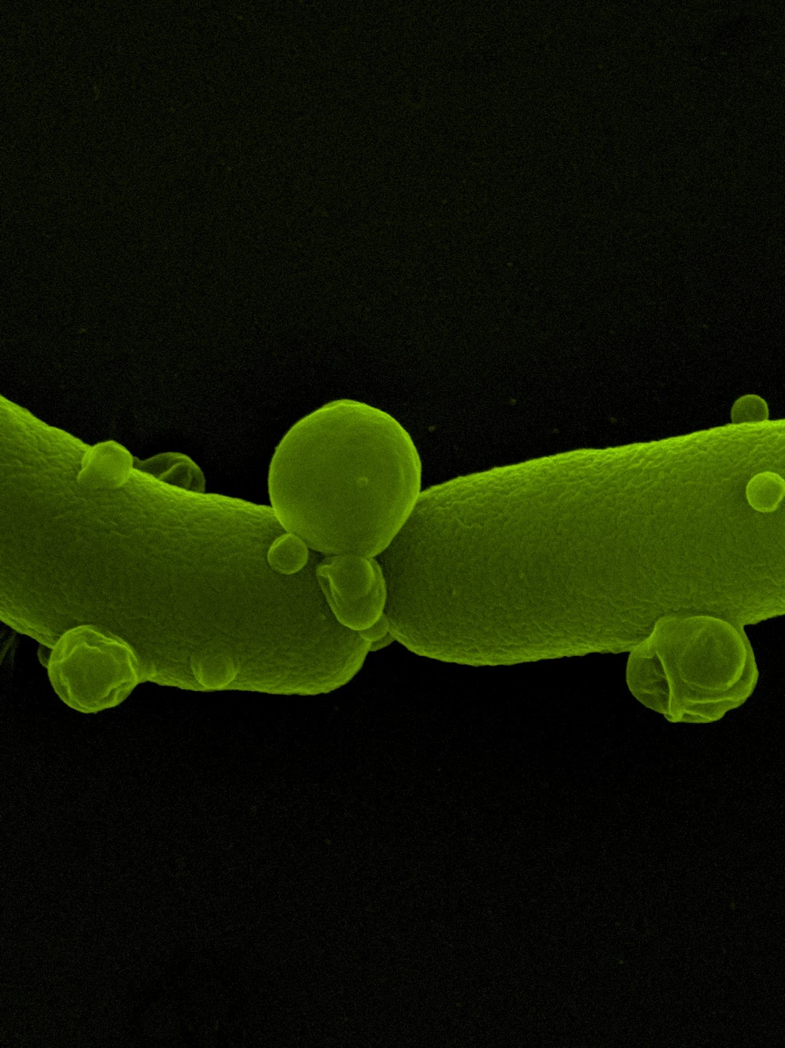 Een Escherichia coli bacterie die aan het sterven is Het gevecht tegen antibioticumresistentie
