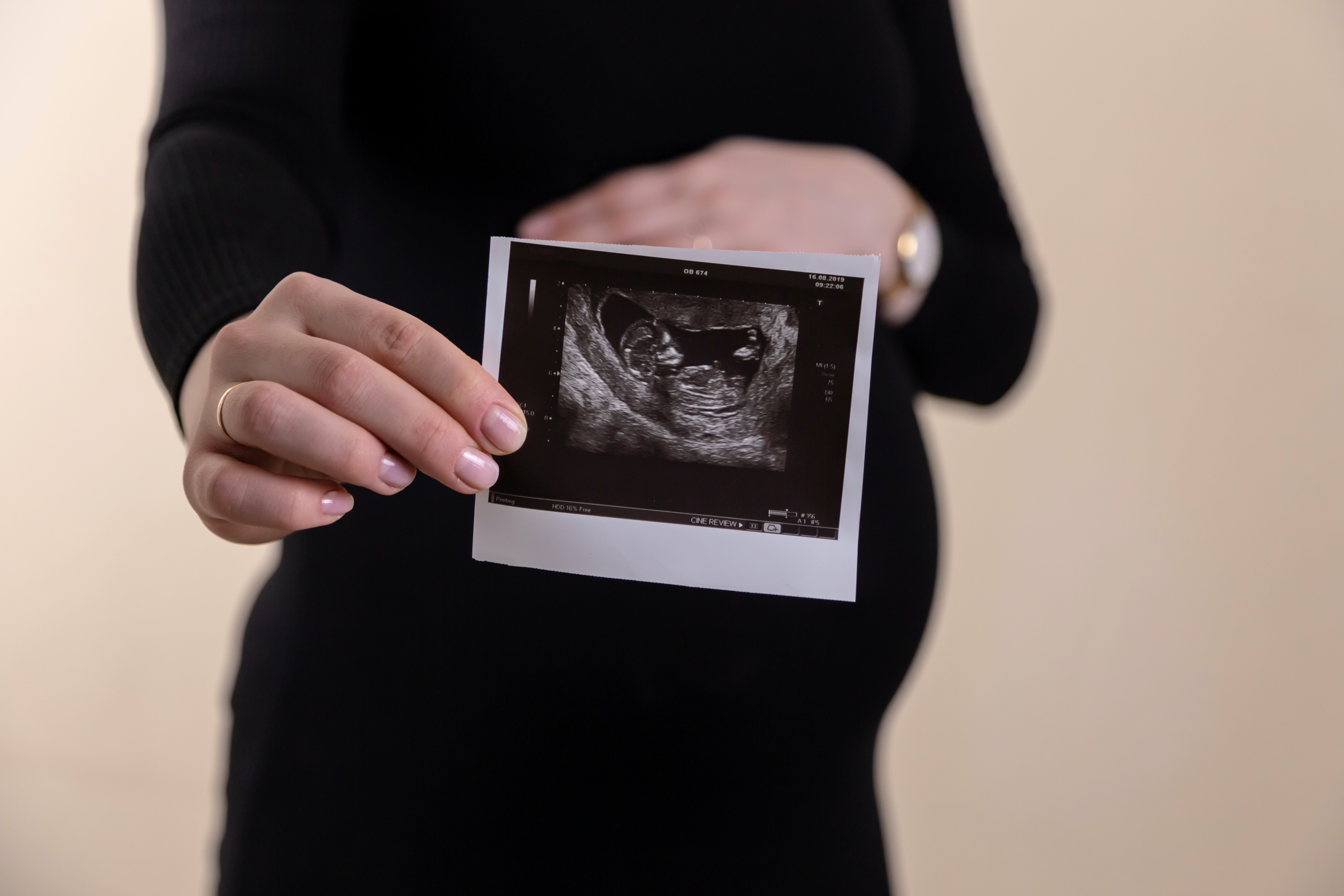 Ongeboren baby bestuurt metabolisme van moeder dankzij 'hebzuchtig' gen van vader
