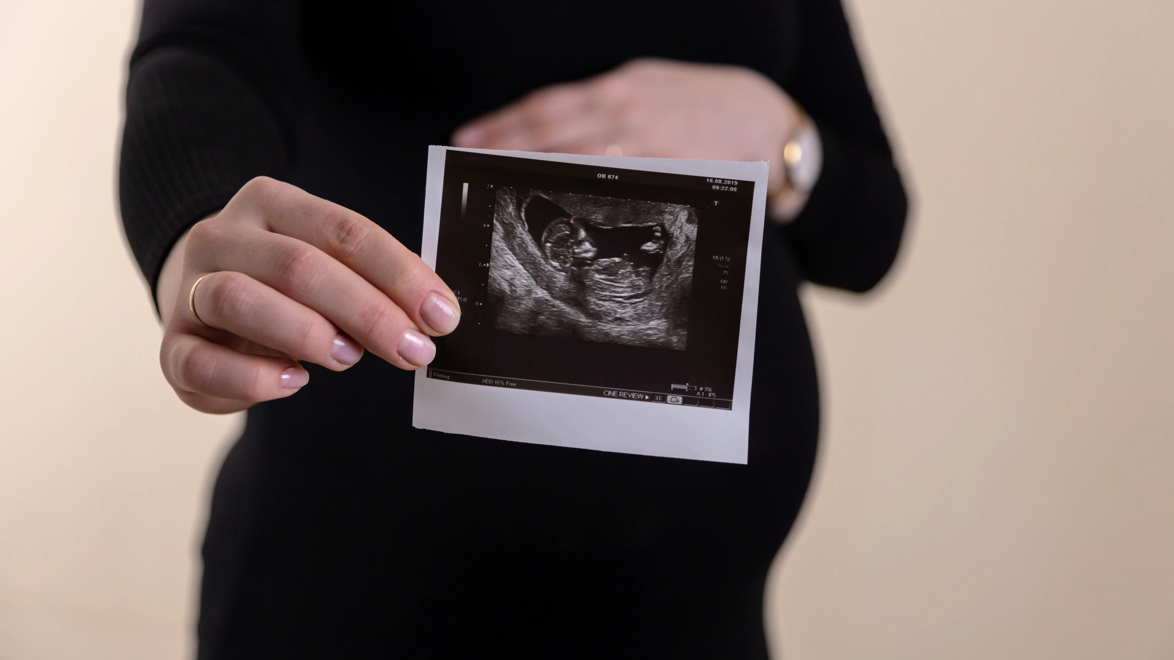 Ongeboren baby bestuurt metabolisme van moeder dankzij 'hebzuchtig' gen van vader