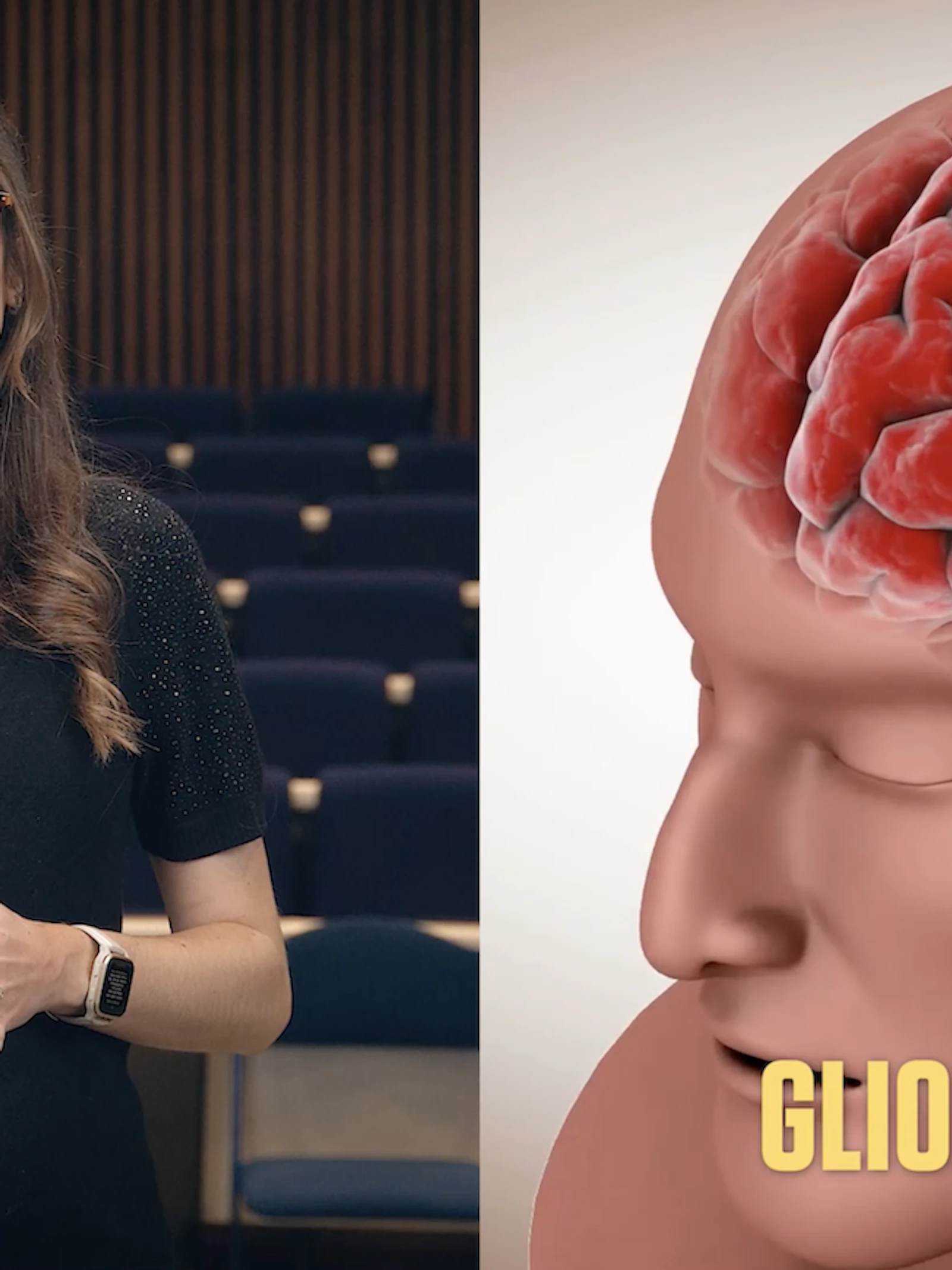 Stamcellen in de strijd tegen hersentumoren