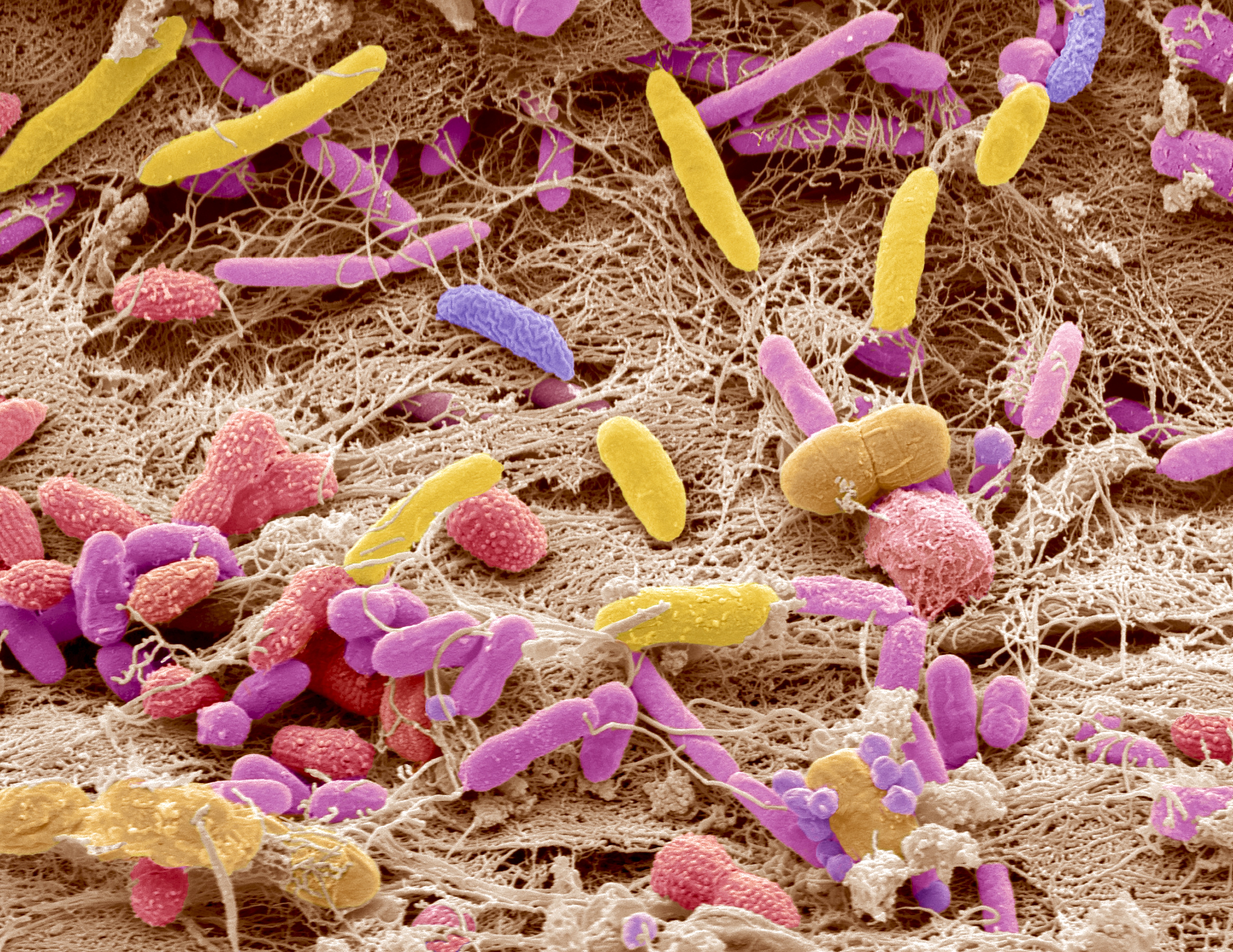Poeptransplantatie spoelt resistente bacteriën weg