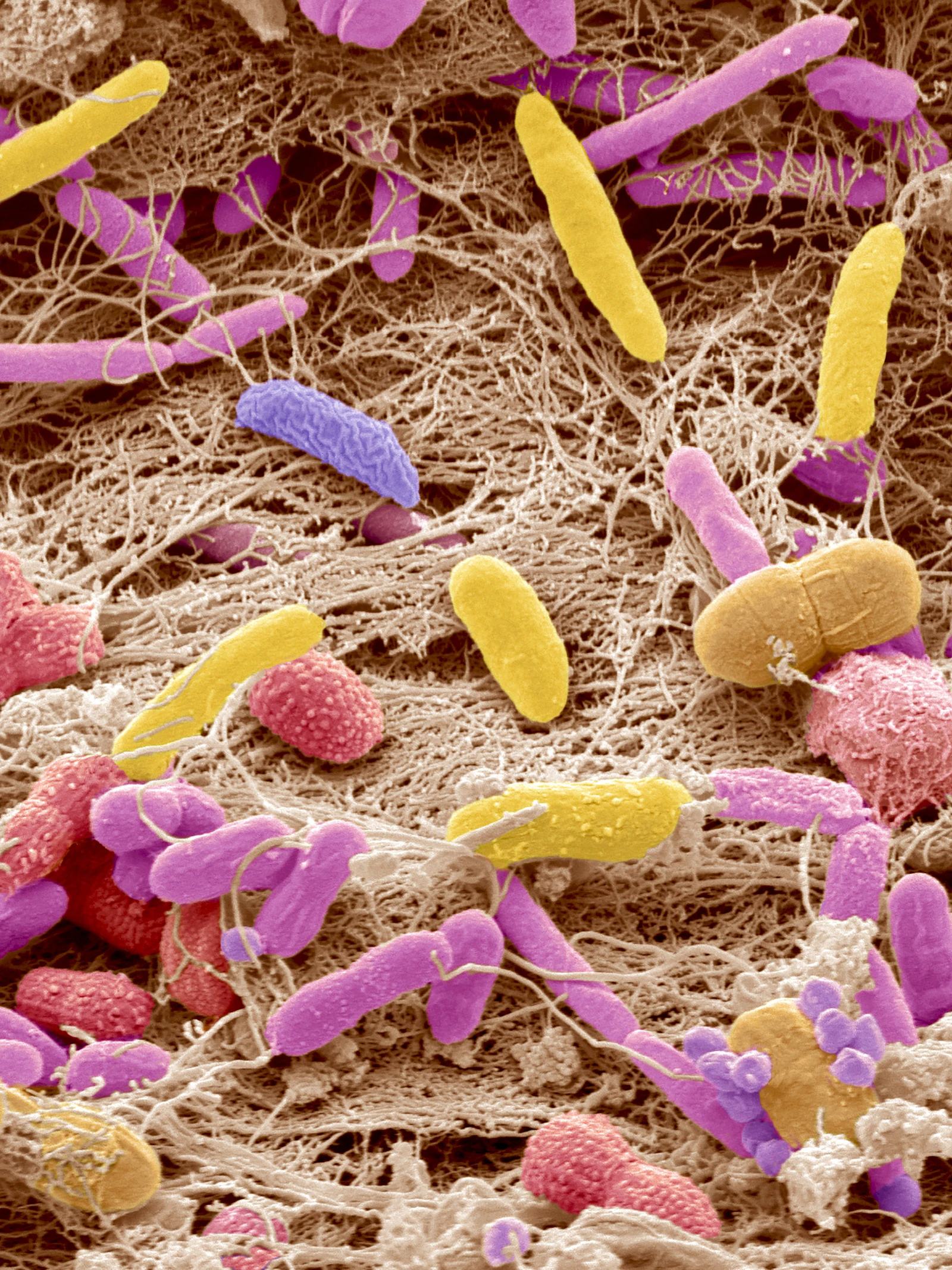 Poeptransplantatie spoelt resistente bacteriën weg