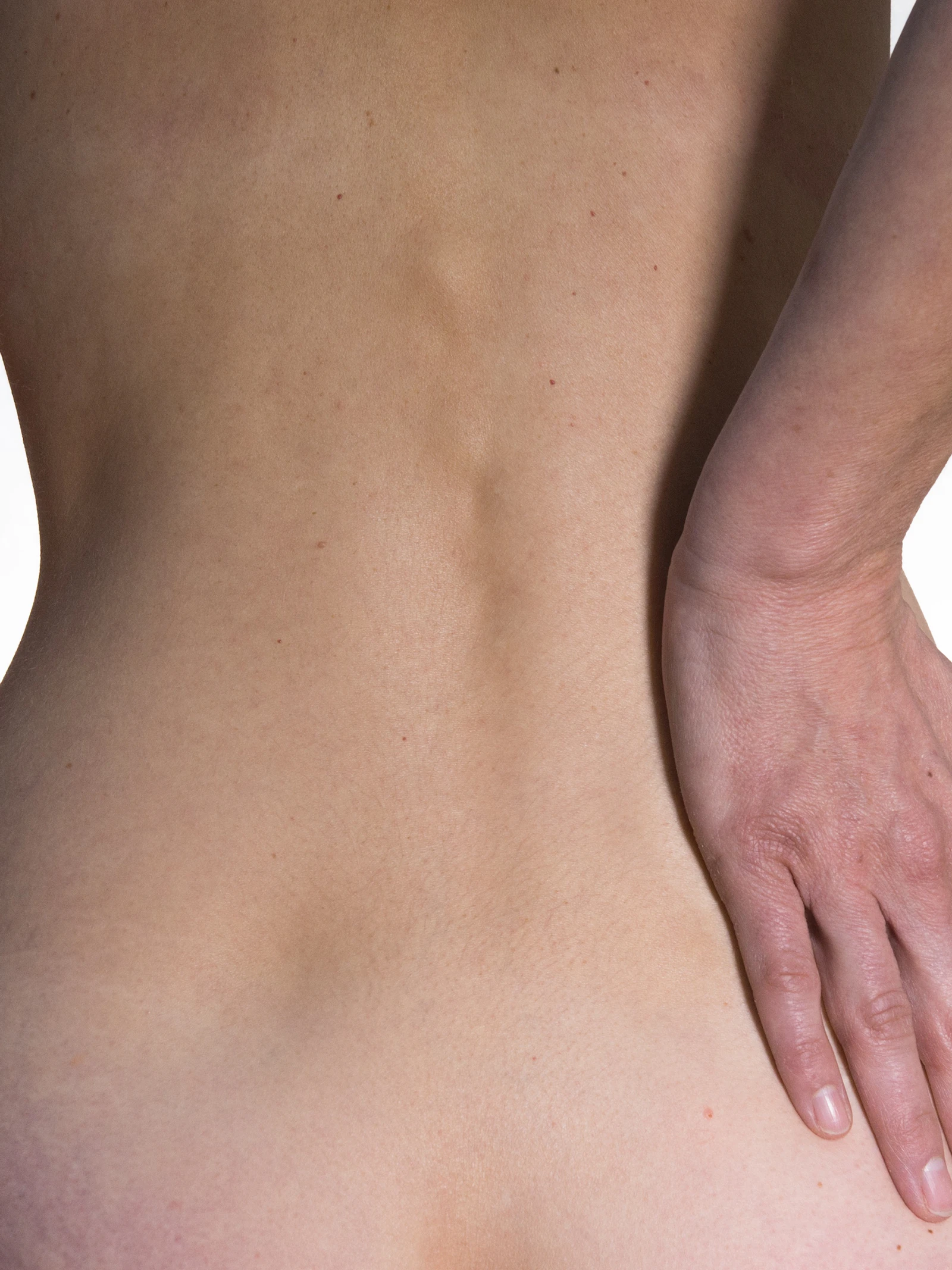 Nieuwe ‘pleister’ herstelt en voorkomt hernia