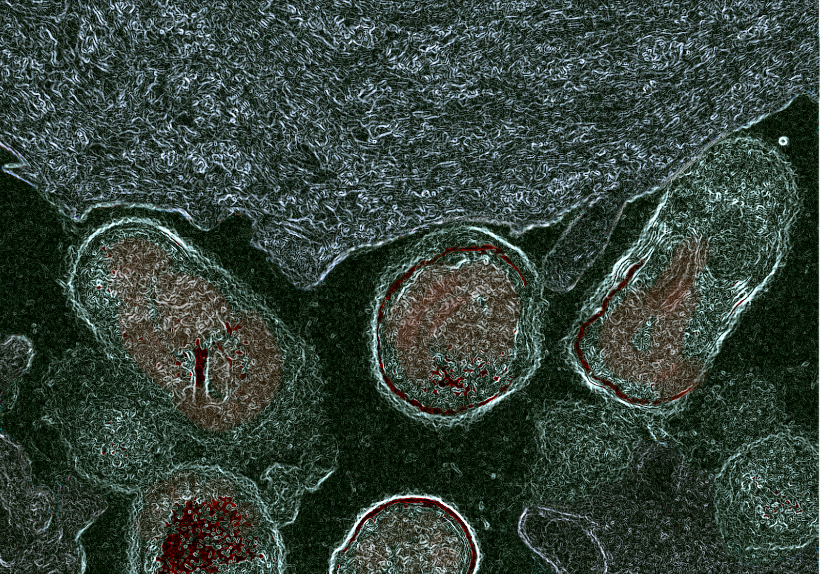 Nieuw inzicht in ontstaan onderbelichte bacteriële vaginose