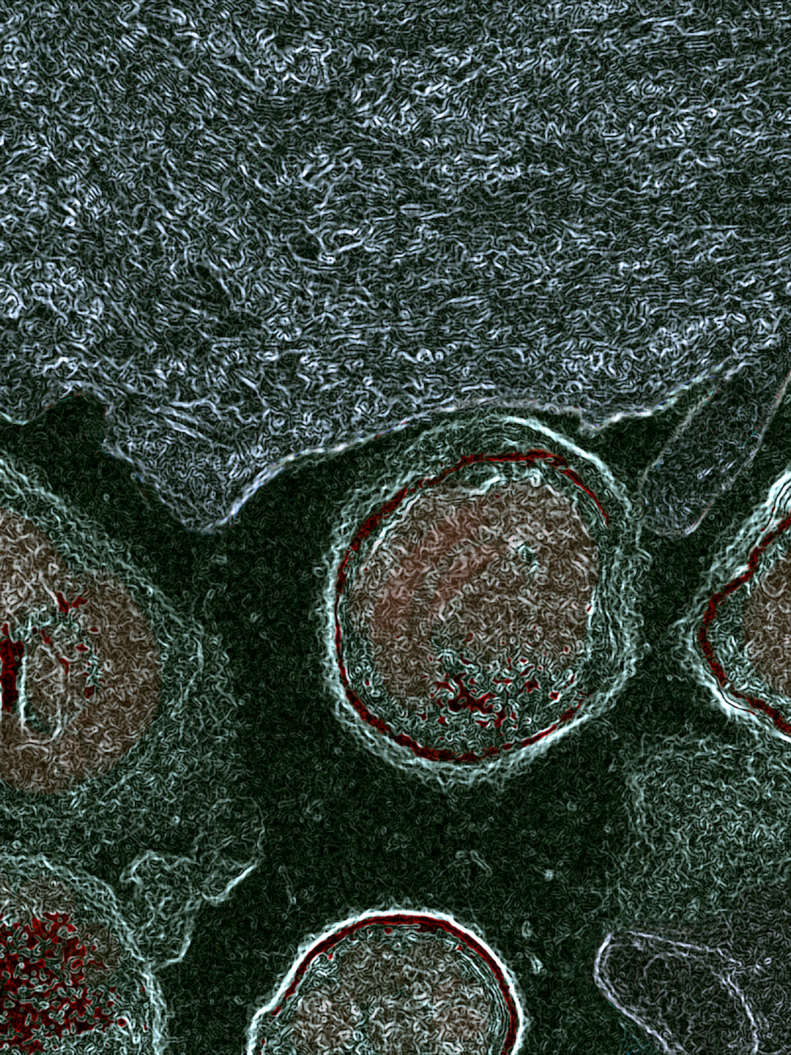 Nieuw inzicht in ontstaan onderbelichte bacteriële vaginose