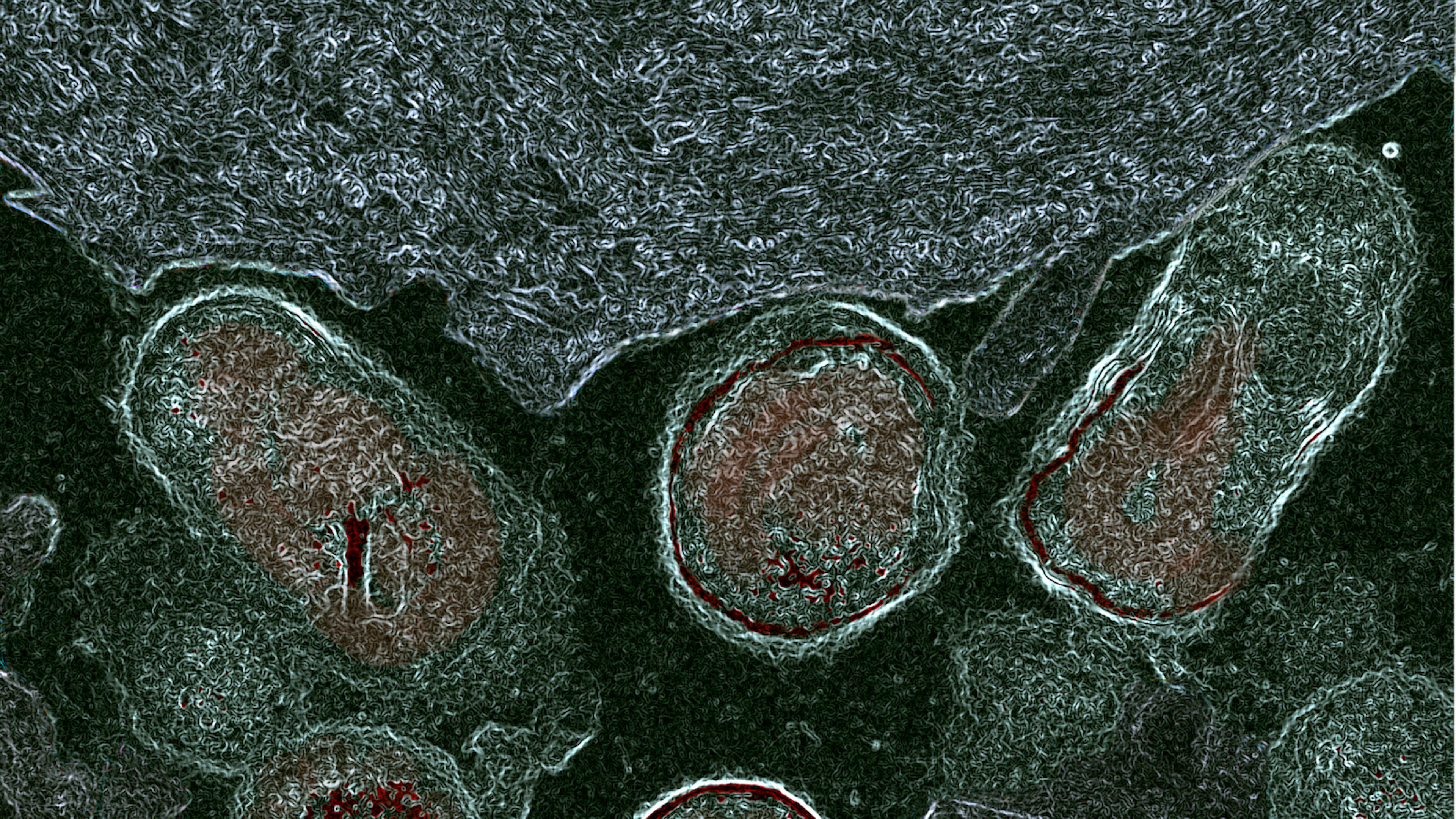 Nieuw inzicht in ontstaan onderbelichte bacteriële vaginose