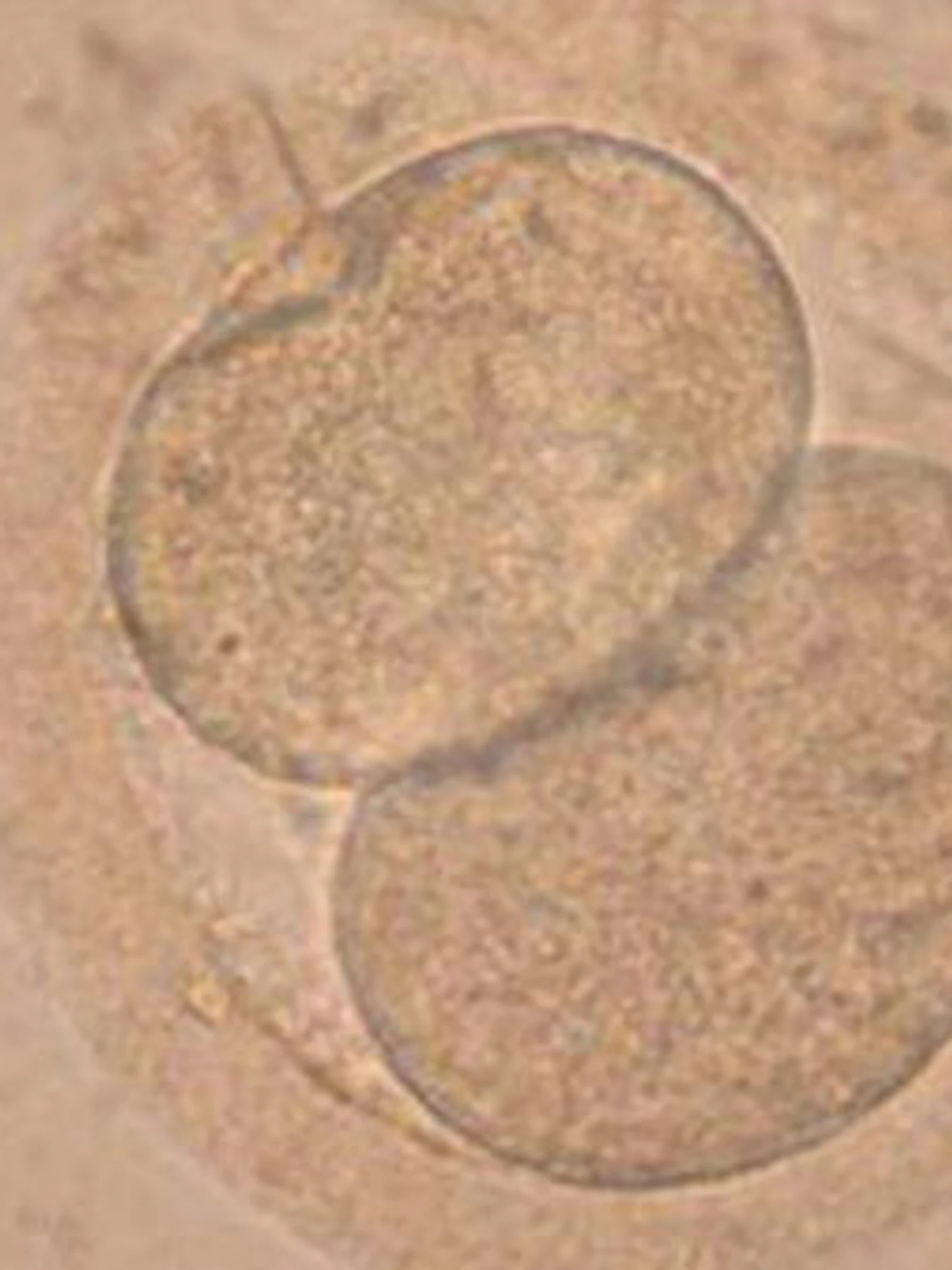 Hoe stokoude virussen een rol spelen bij de vorming van een embryo