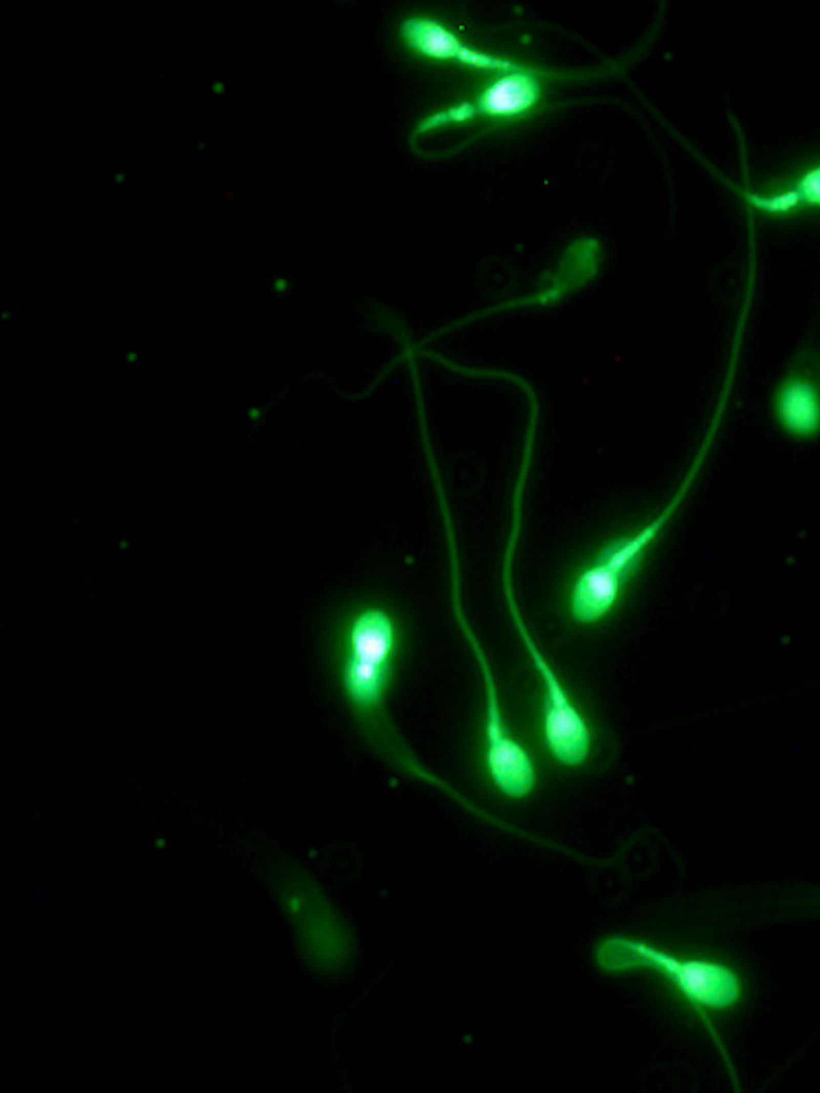 Ultrasoon geluid verhoogt de beweeglijkheid van zaadcellen