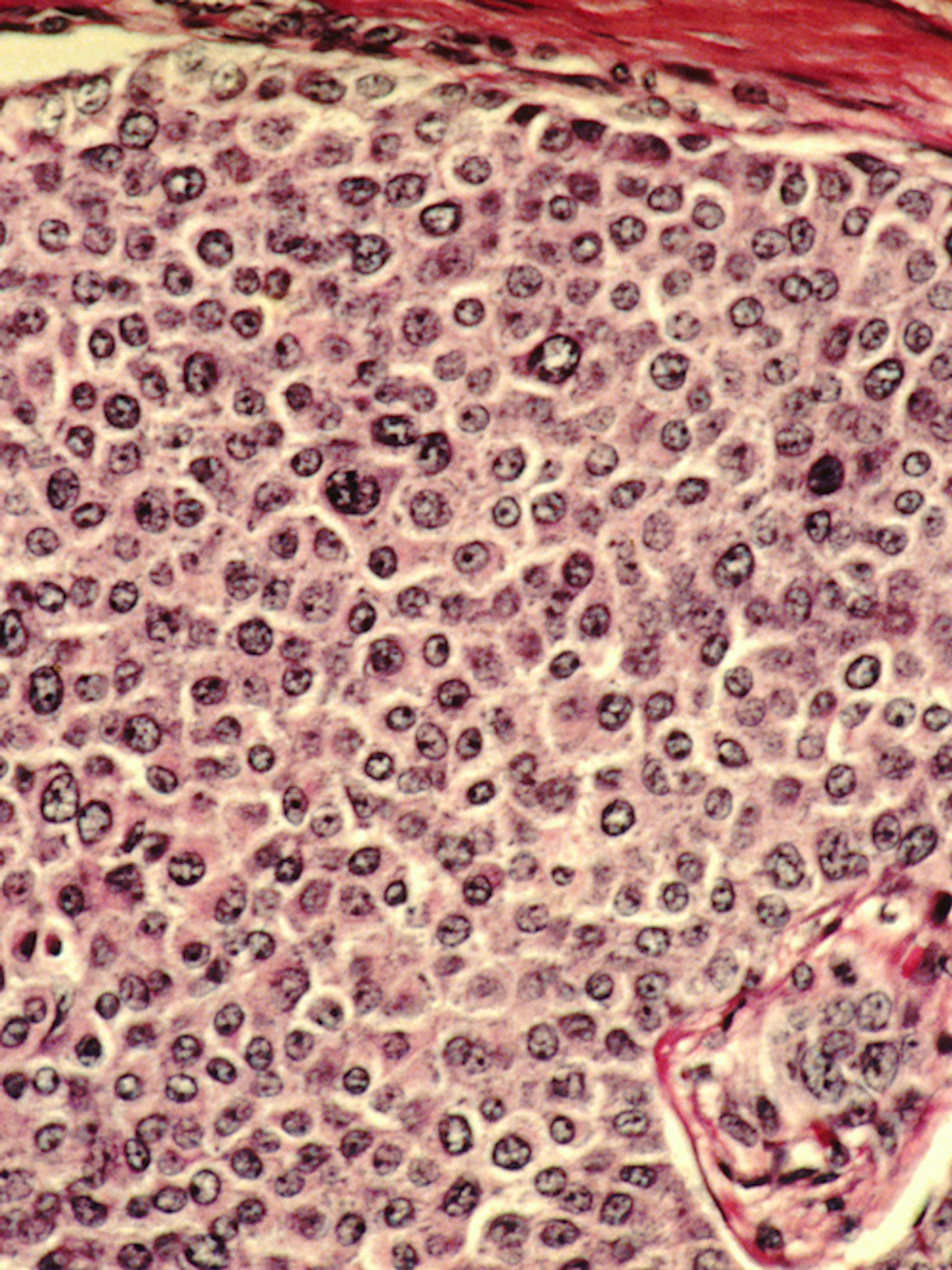 Hoe bacteriën kanker en kankerbehandelingen beïnvloeden