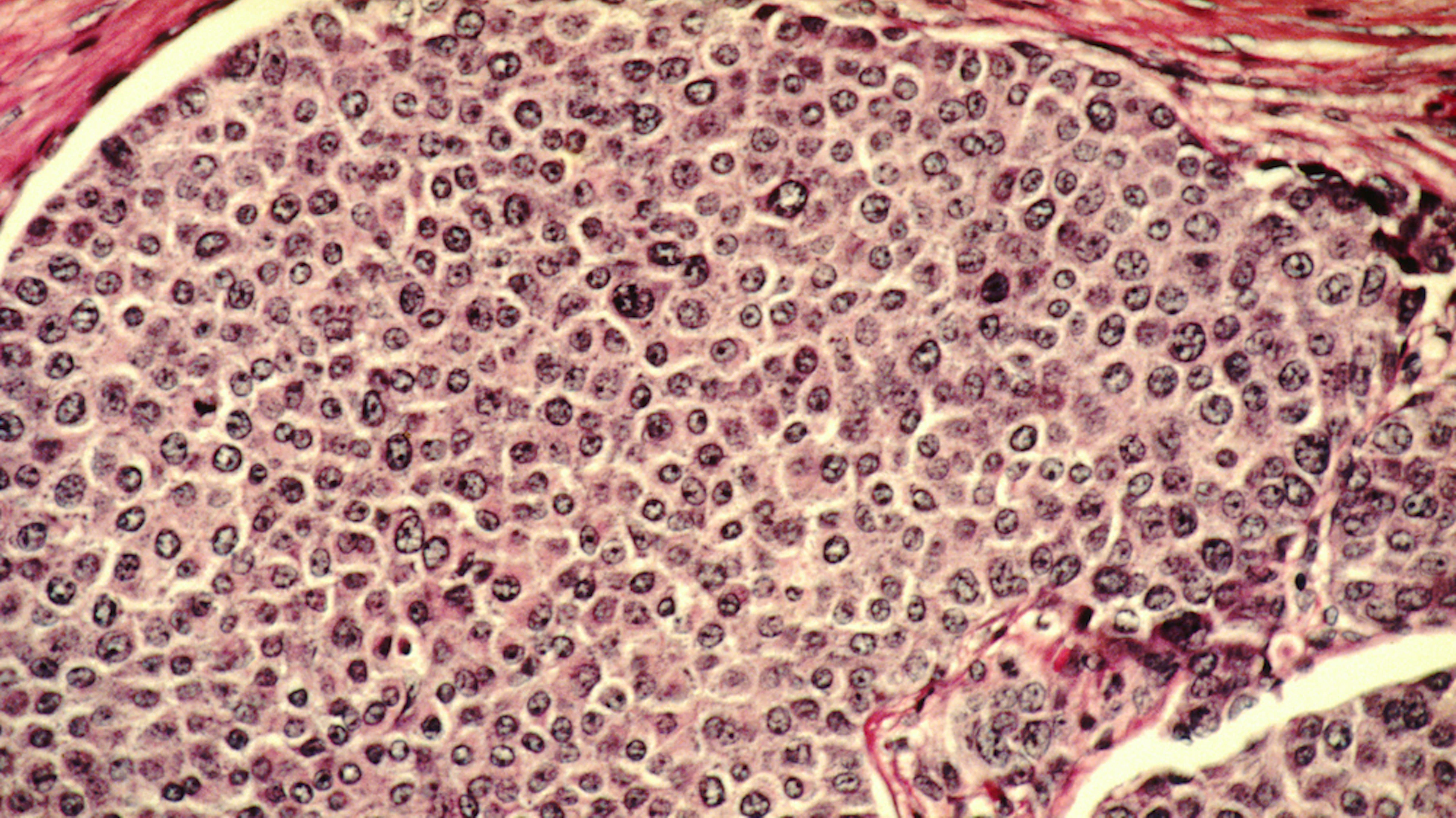 Hoe bacteriën kanker en kankerbehandelingen beïnvloeden