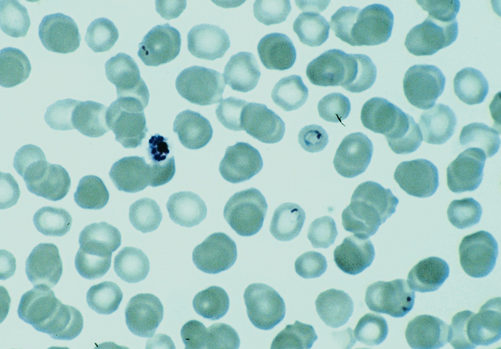 Plasmodium falciparum Beeld: Institute of Tropical Medicine.