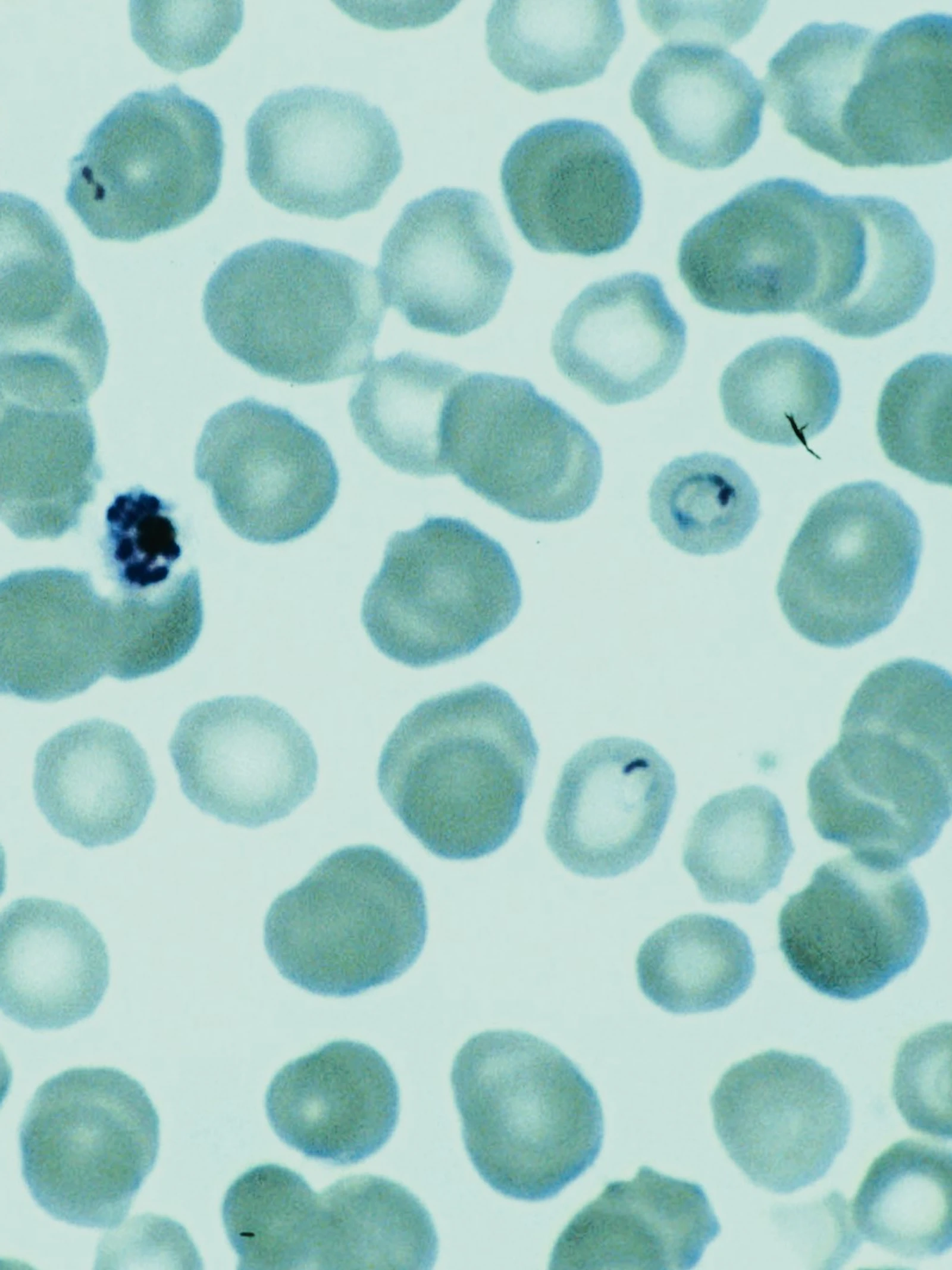 Plasmodium falciparum Beeld: Institute of Tropical Medicine.