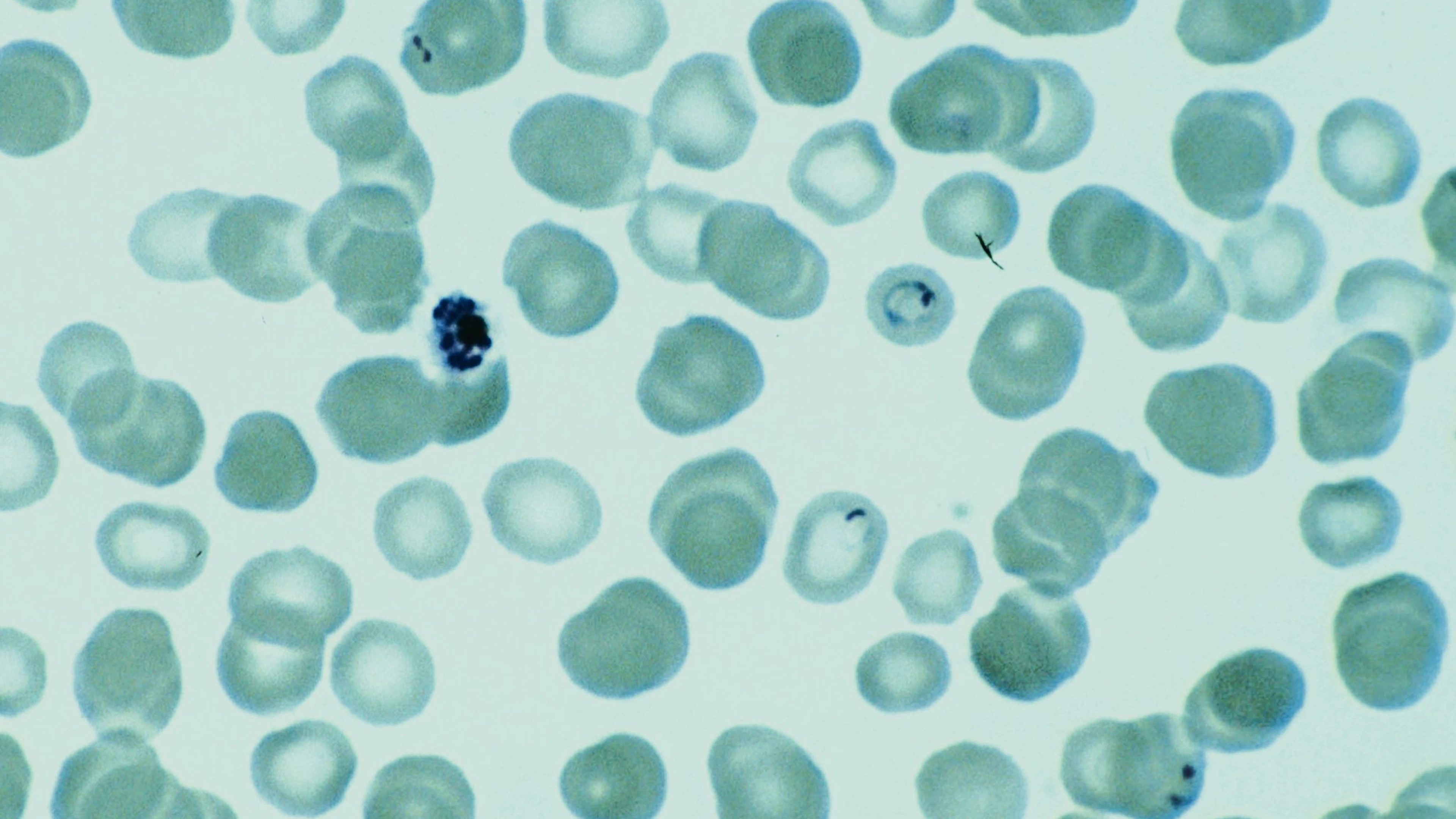Plasmodium falciparum Beeld: Institute of Tropical Medicine.