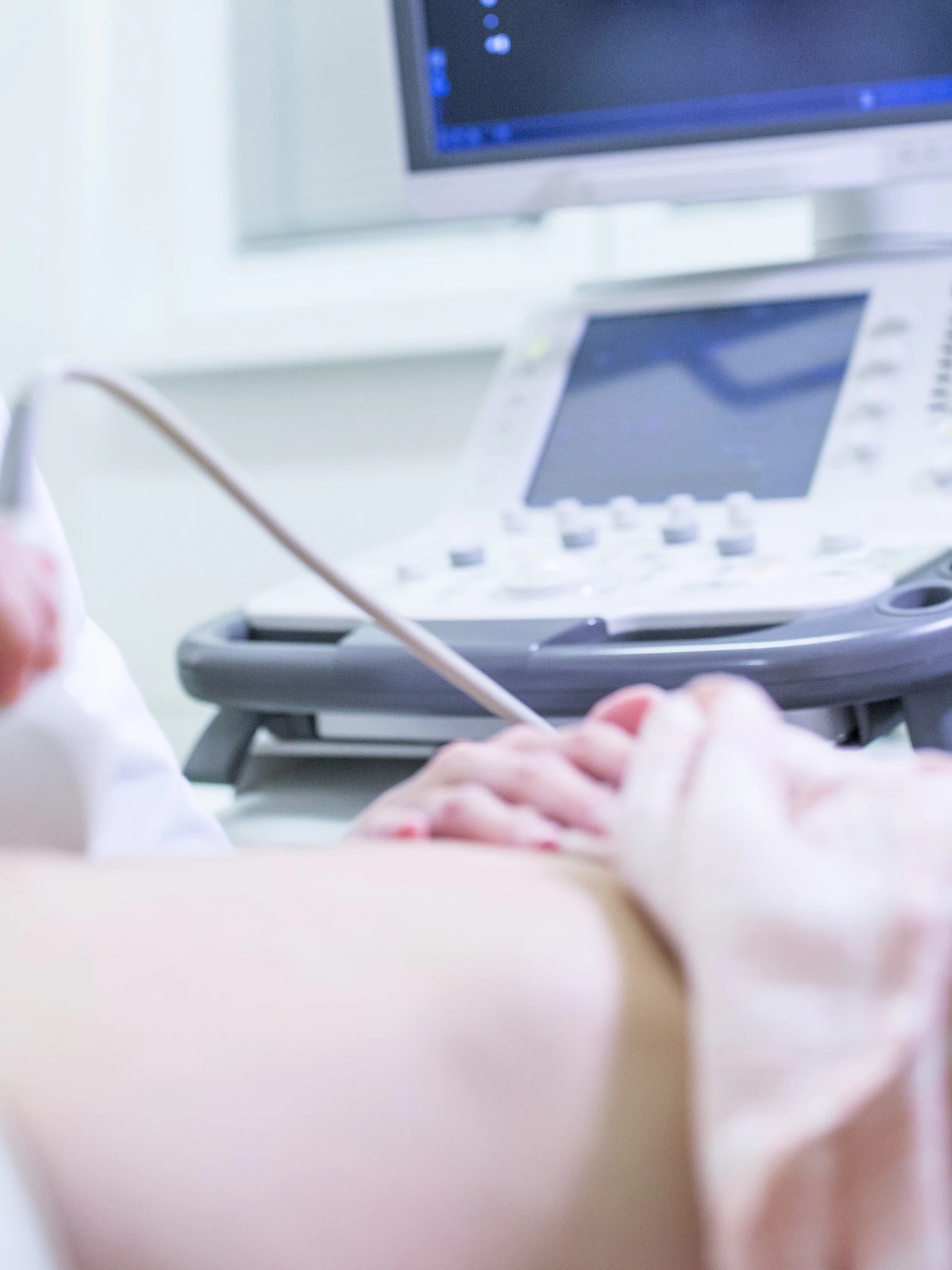 Malariamiddel heeft mogelijk gunstig effect op PCOS