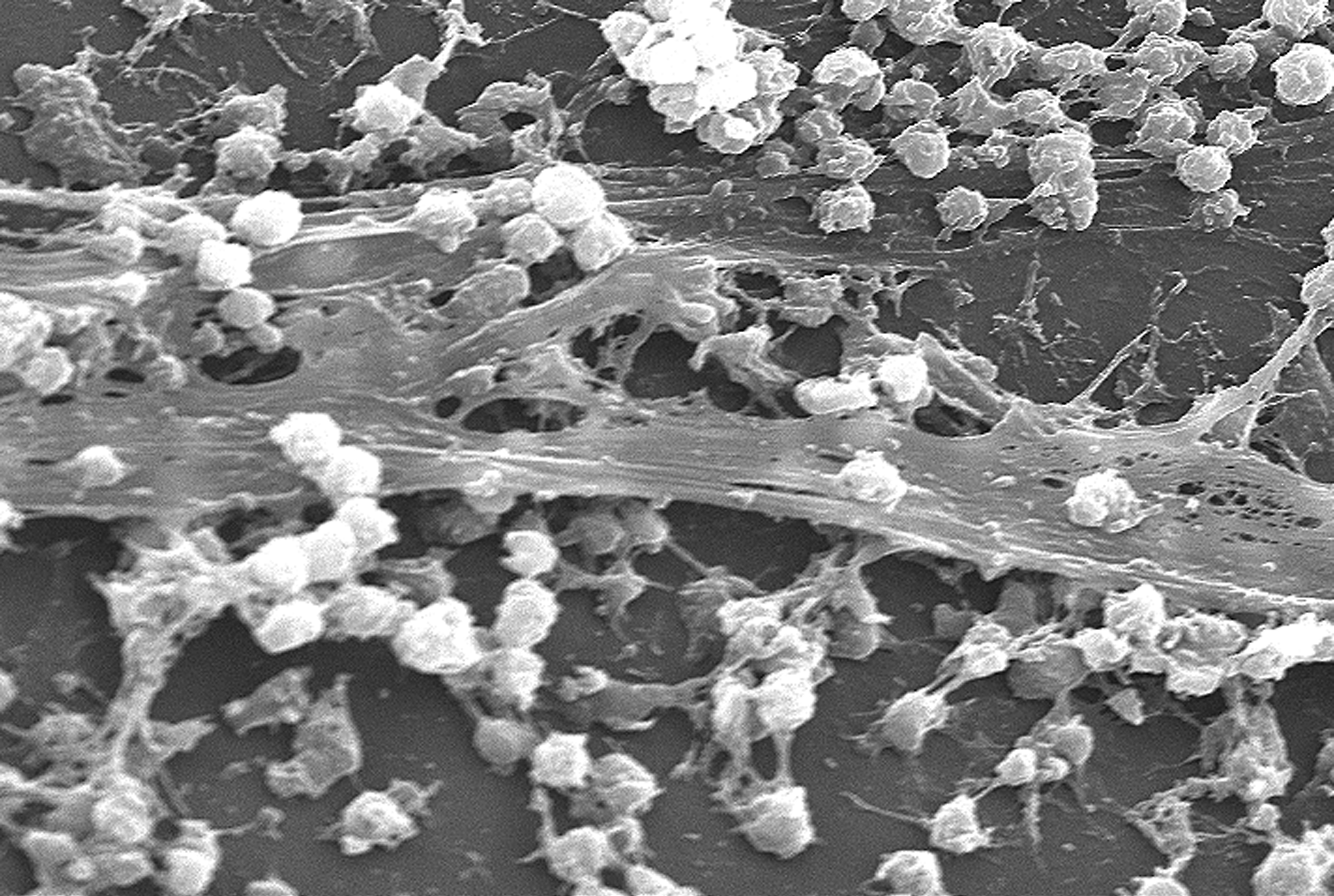 Met deze slijmlaag beschermen bacteriën zich tegen antibiotica