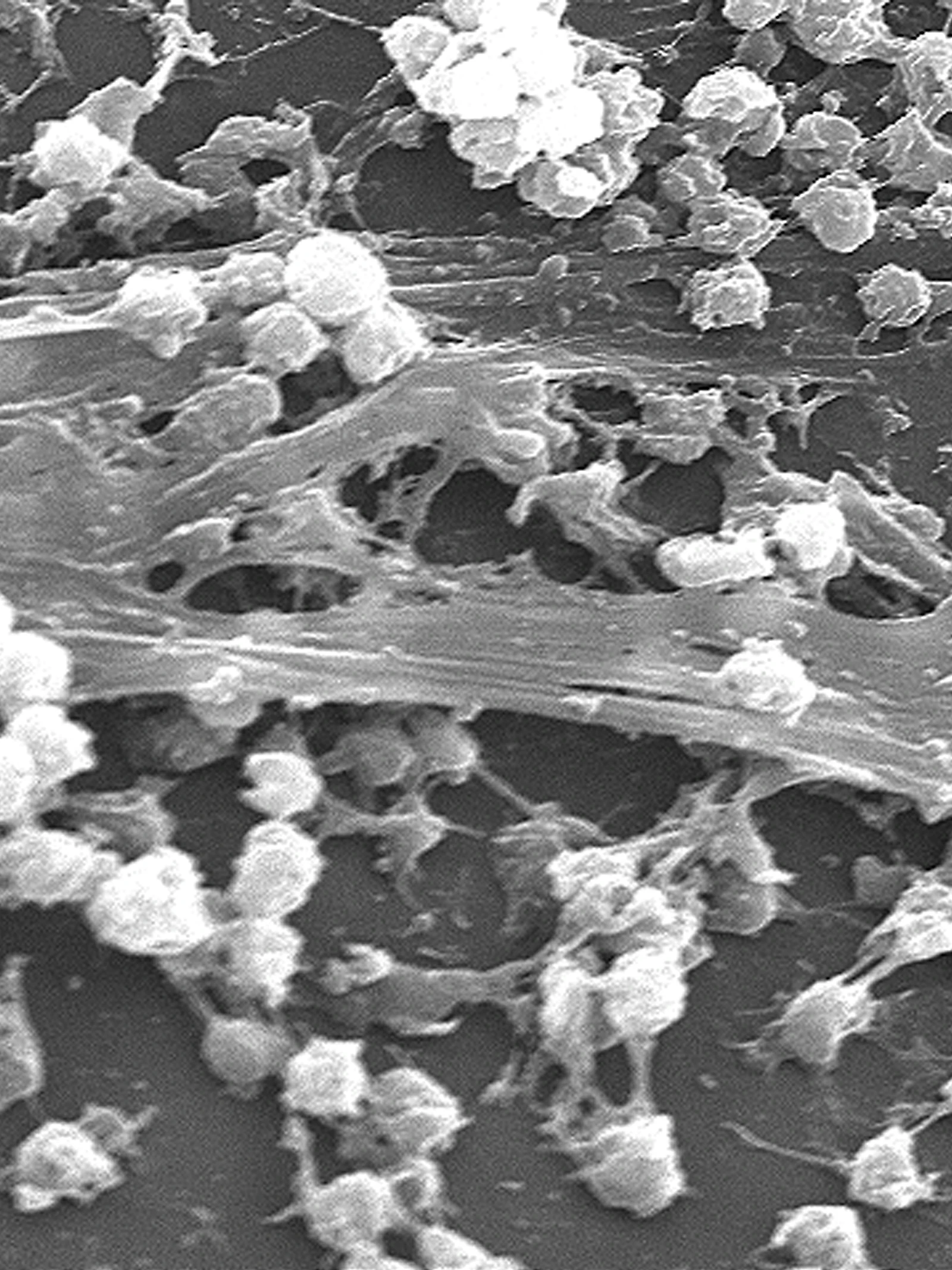 Met deze slijmlaag beschermen bacteriën zich tegen antibiotica