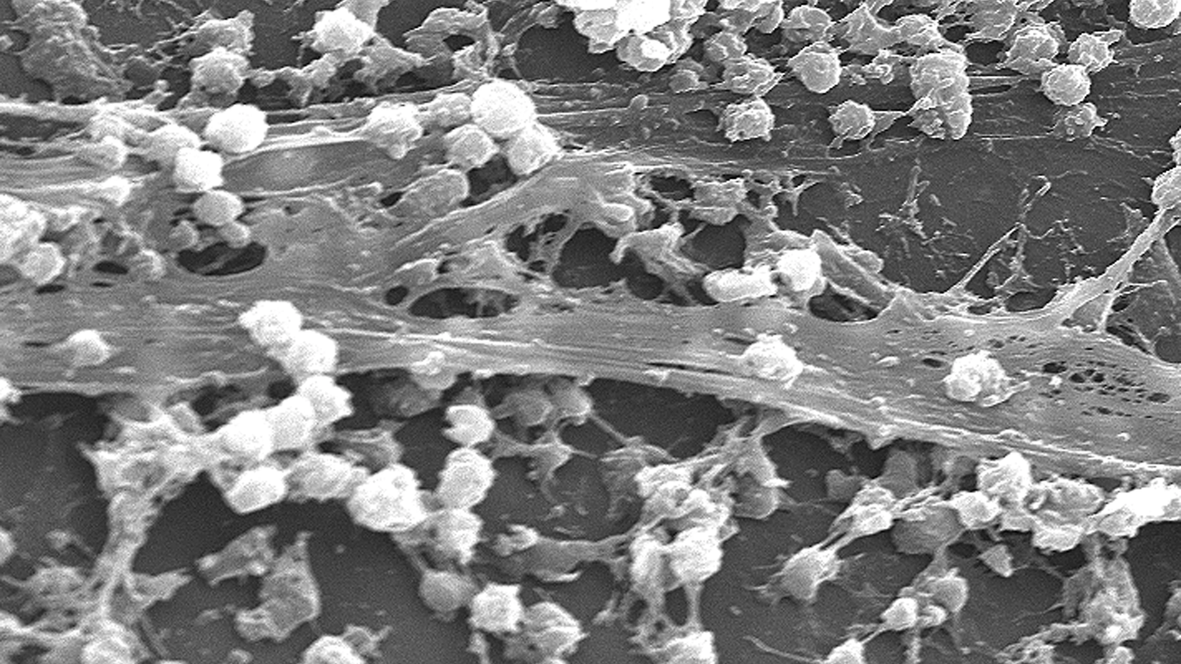Met deze slijmlaag beschermen bacteriën zich tegen antibiotica