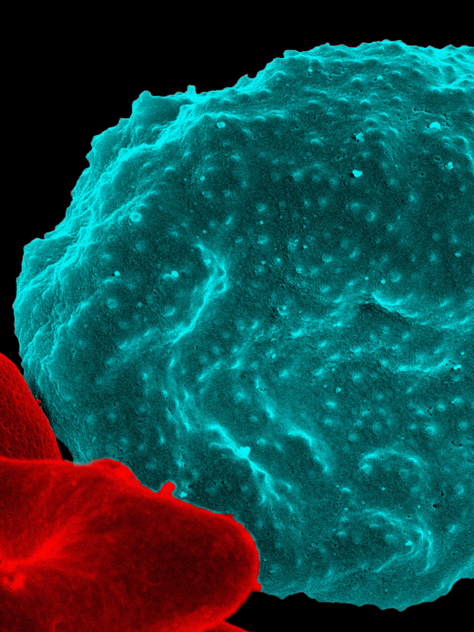 Niet alleen bacteriën, maar ook schimmels en parasieten worden resistent