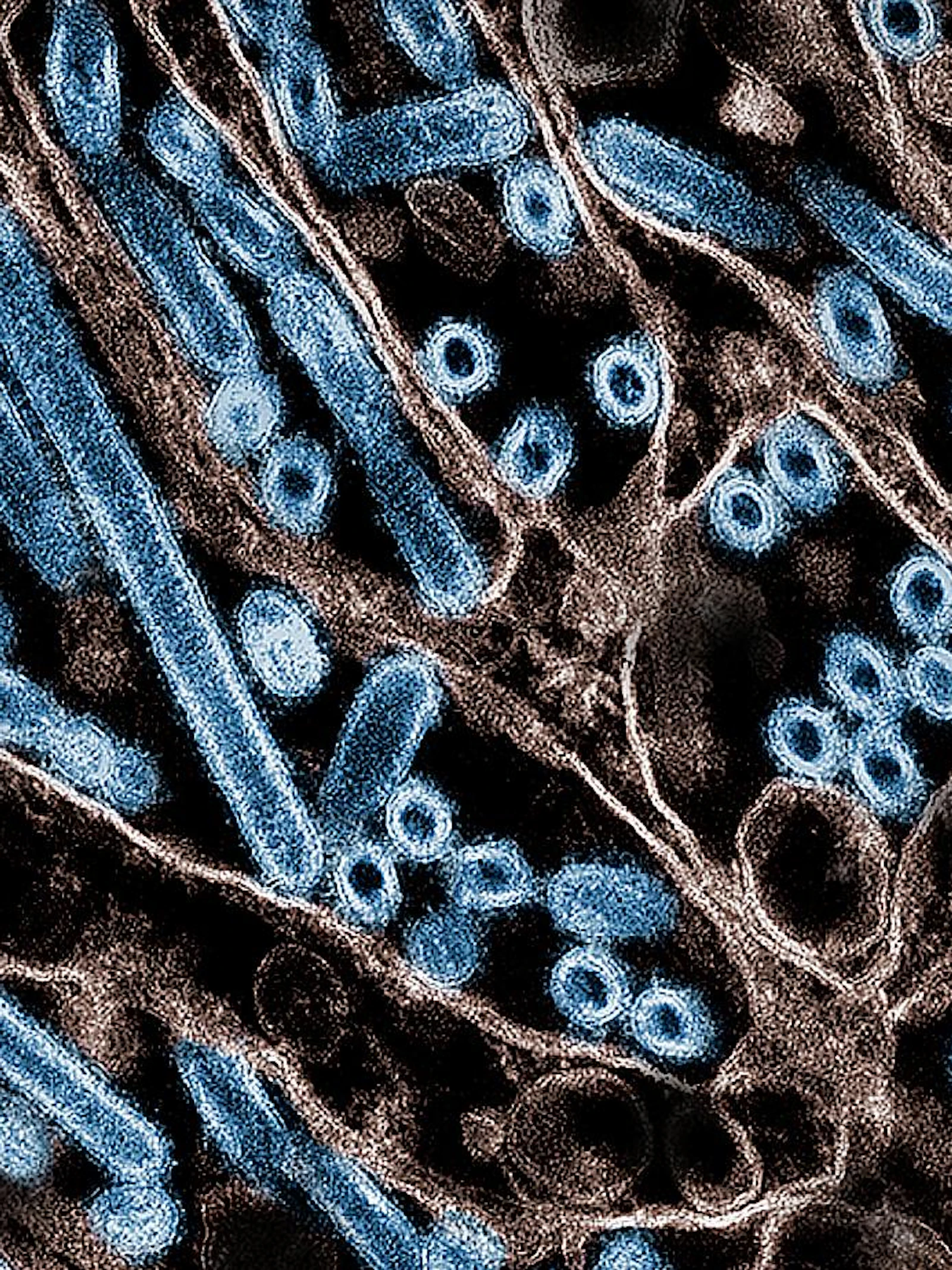 Vogelgriepvirus heeft maar één mutatie nodig om efficiënter aan menselijke cellen te binden