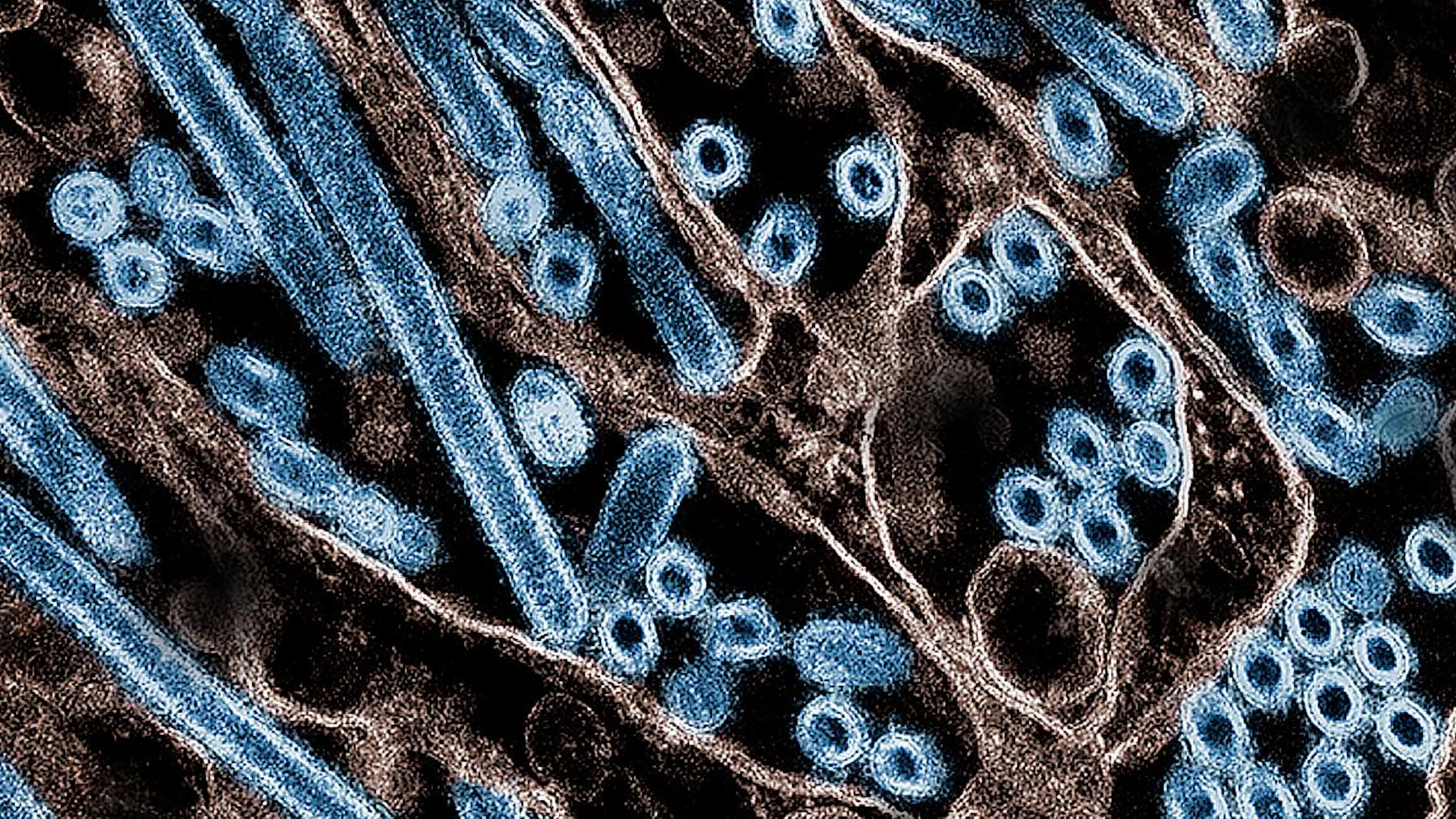 Vogelgriepvirus heeft maar één mutatie nodig om efficiënter aan menselijke cellen te binden