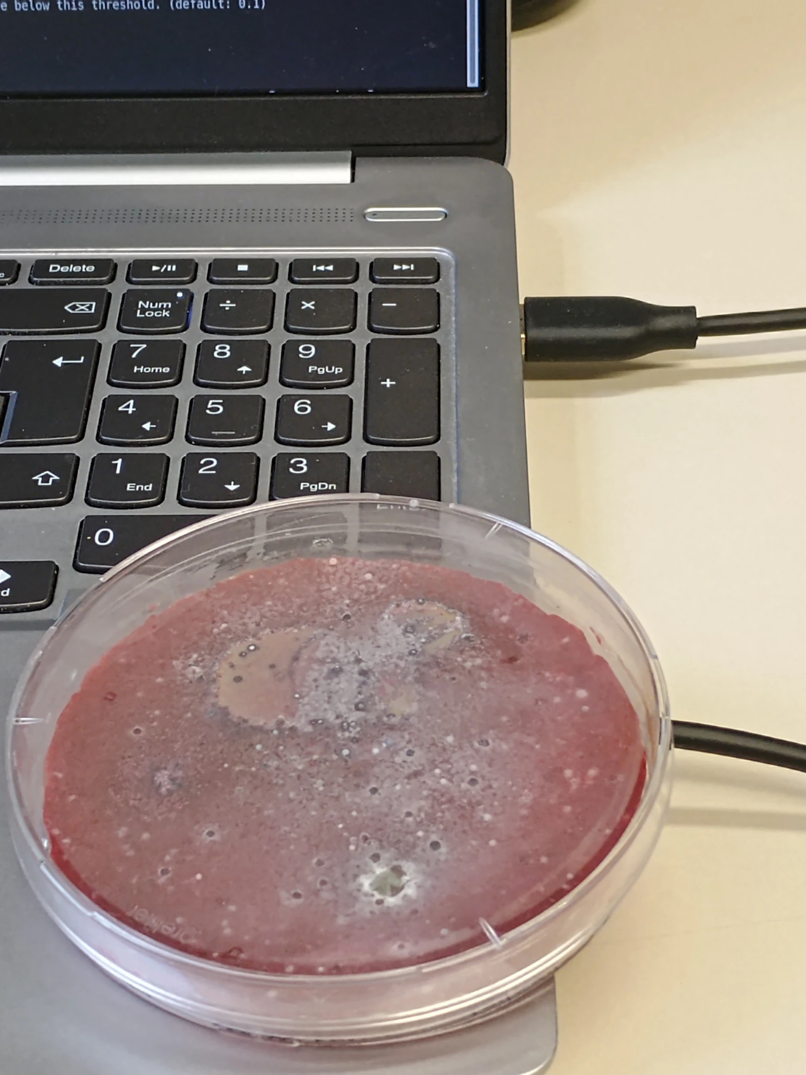AI en microben: een ongewoon bondgenootschap tegen antibioticaresistentie
