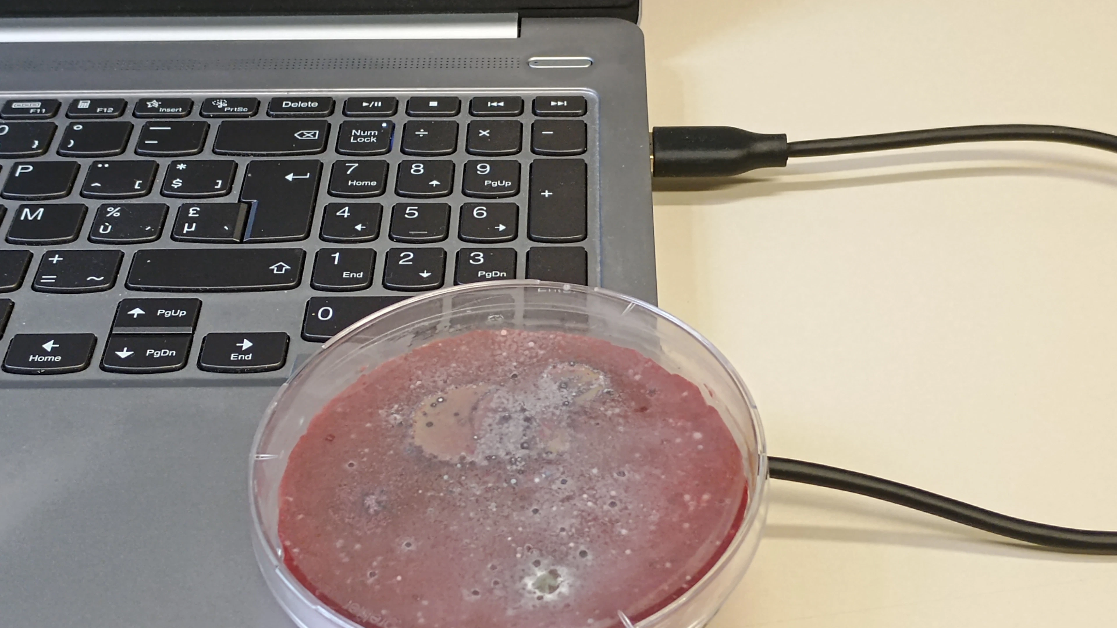 AI en microben: een ongewoon bondgenootschap tegen antibioticaresistentie