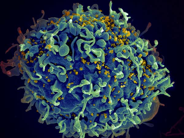 Nieuwe behandeling maakt hiv-virus wellicht definitief onschadelijk