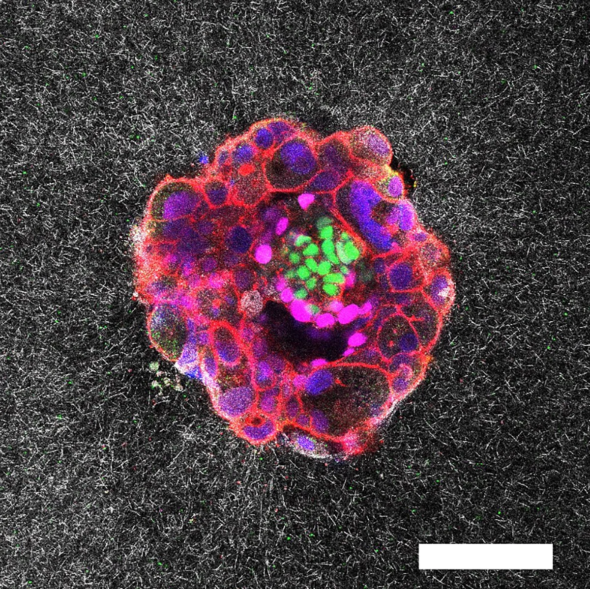 Eerste 3D-beelden van de implantatie van menselijke embryo's onthullen nieuwe details over het proces