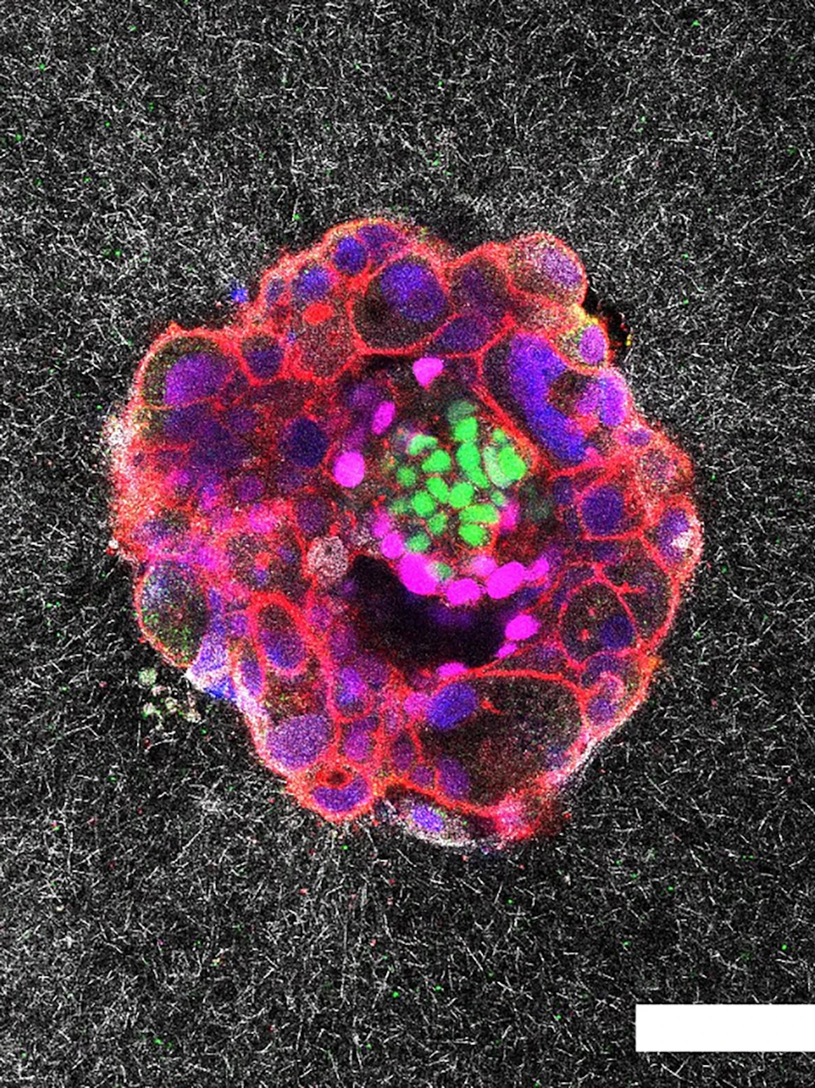 Eerste 3D-beelden van de implantatie van menselijke embryo's onthullen nieuwe details over het proces
