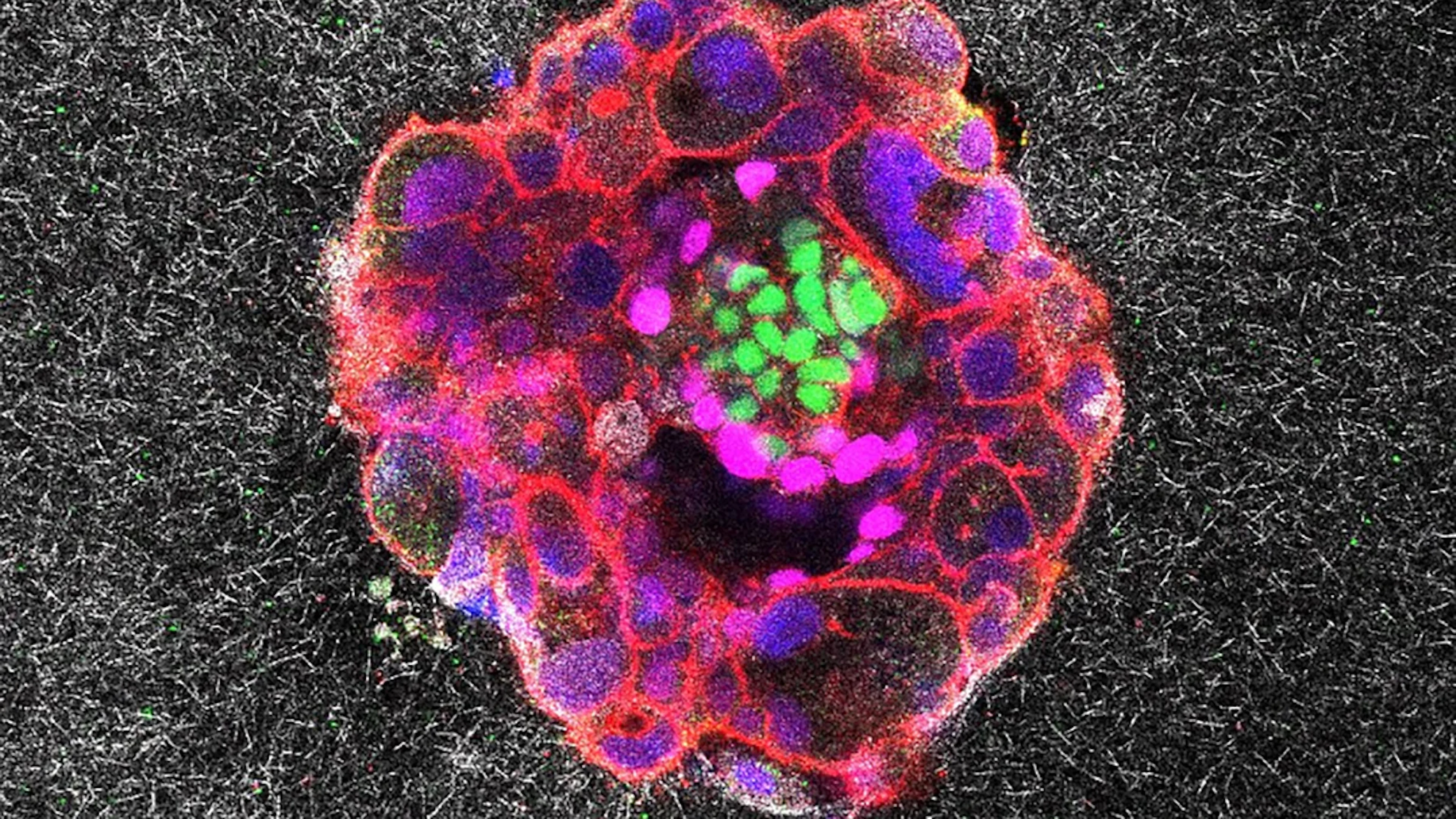 Eerste 3D-beelden van de implantatie van menselijke embryo's onthullen nieuwe details over het proces