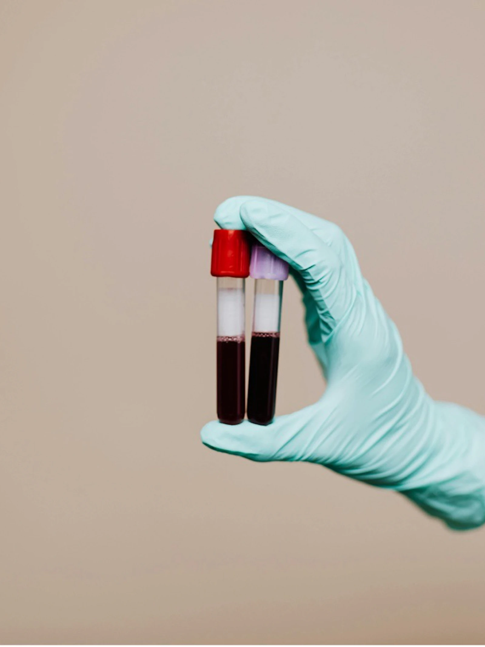 RNA verklikt tumor vroegtijdig