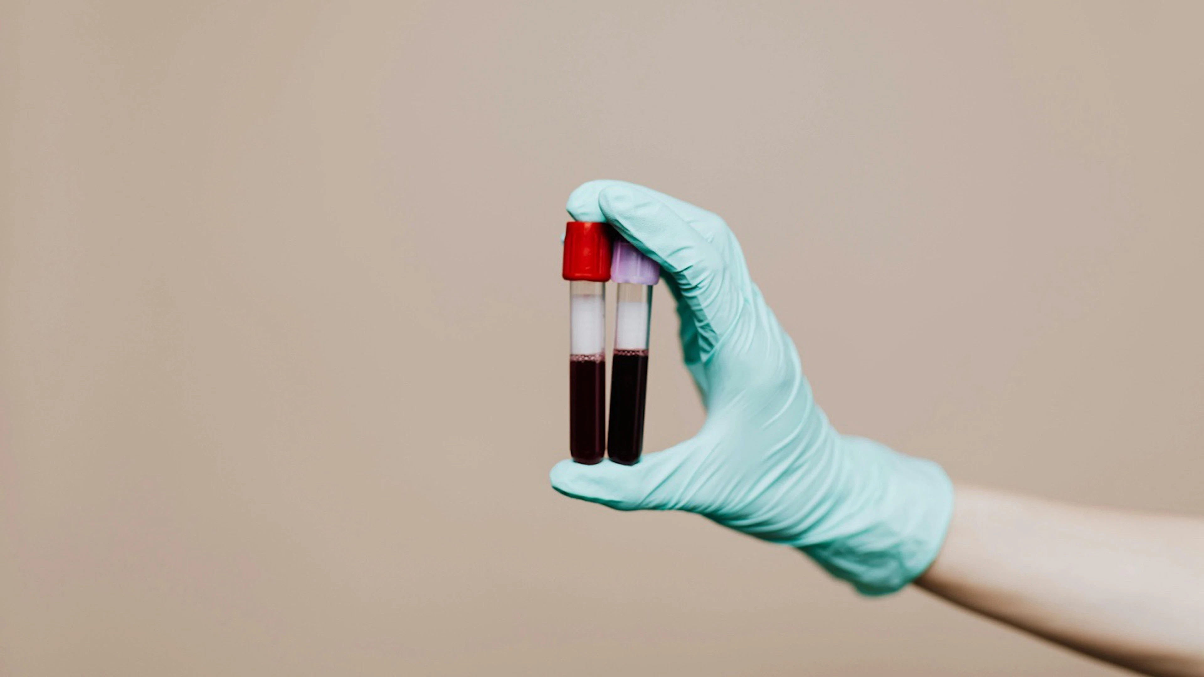 RNA verklikt tumor vroegtijdig