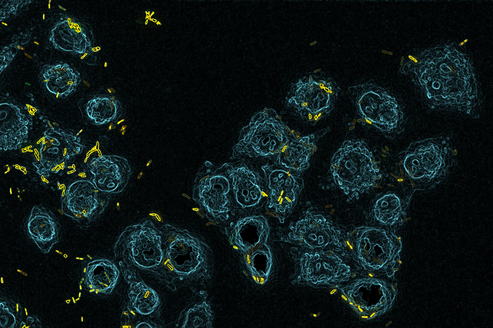 Deze bacterieschurk is slim en invasief