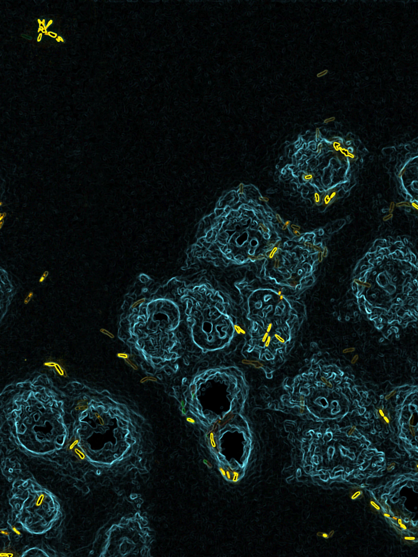 Deze bacterieschurk is slim en invasief