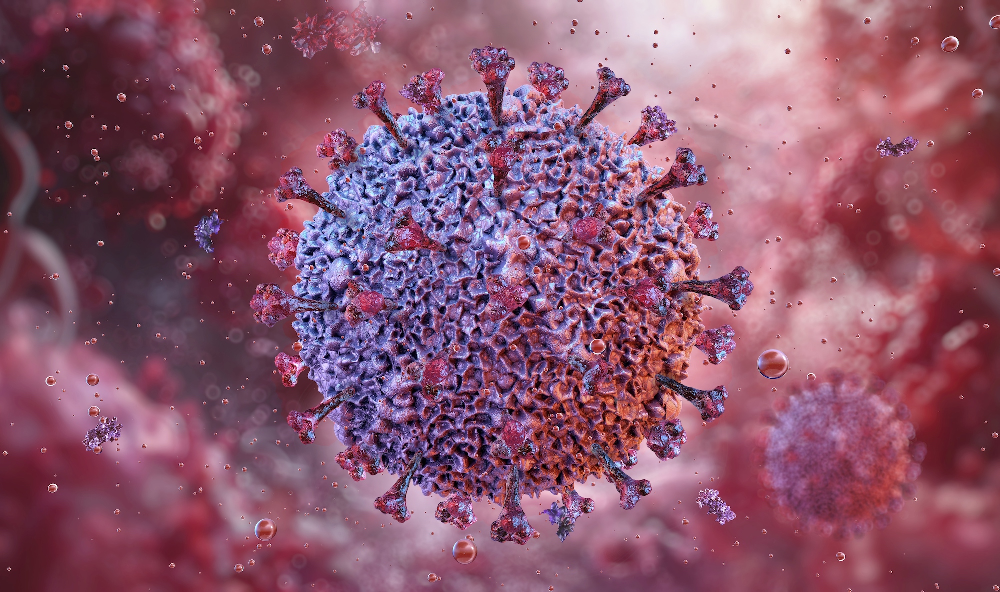Het klierkoortsvirus kan ook lupus veroorzaken