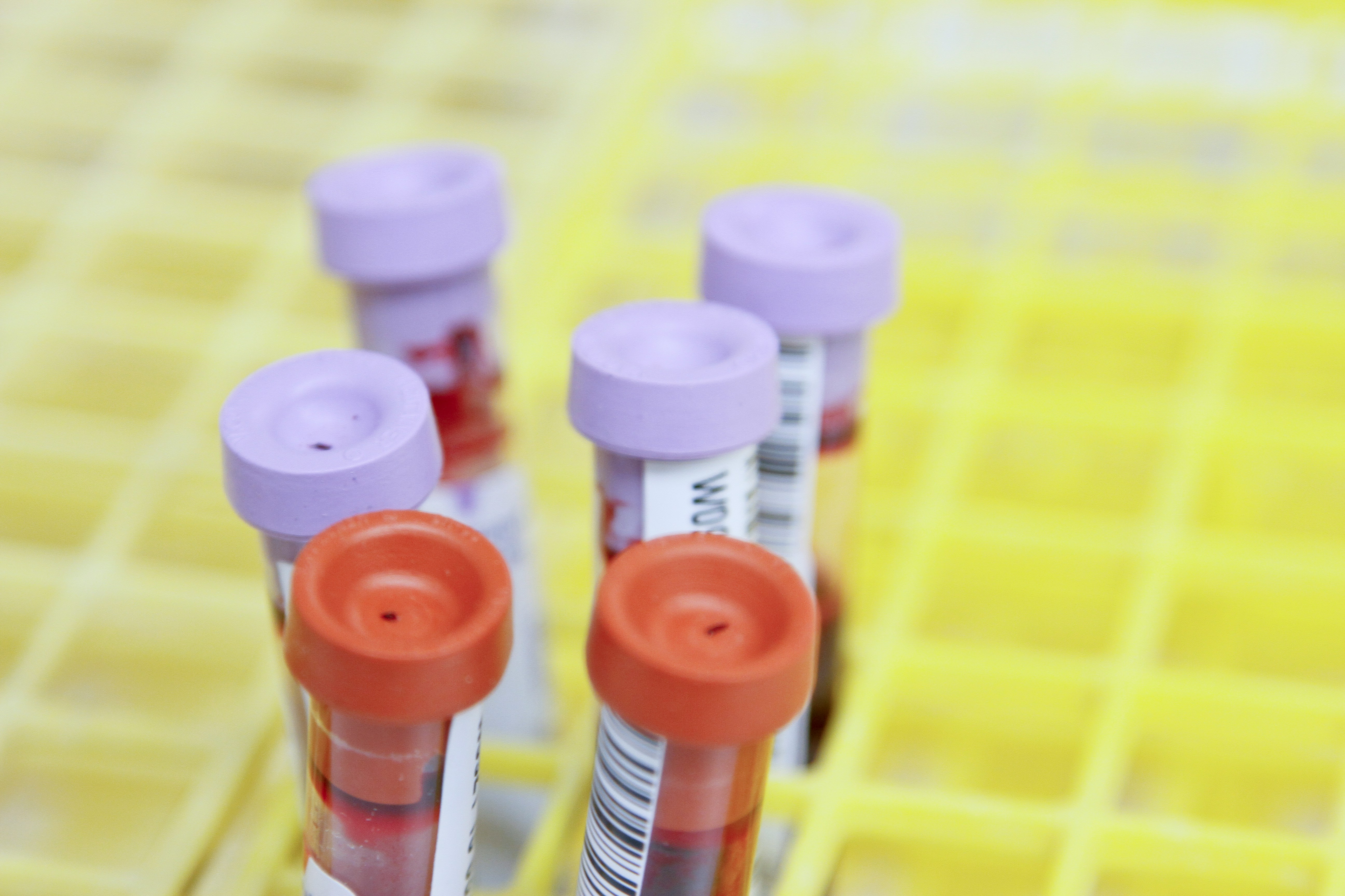 Hematologen op zoek naar de heilige graal