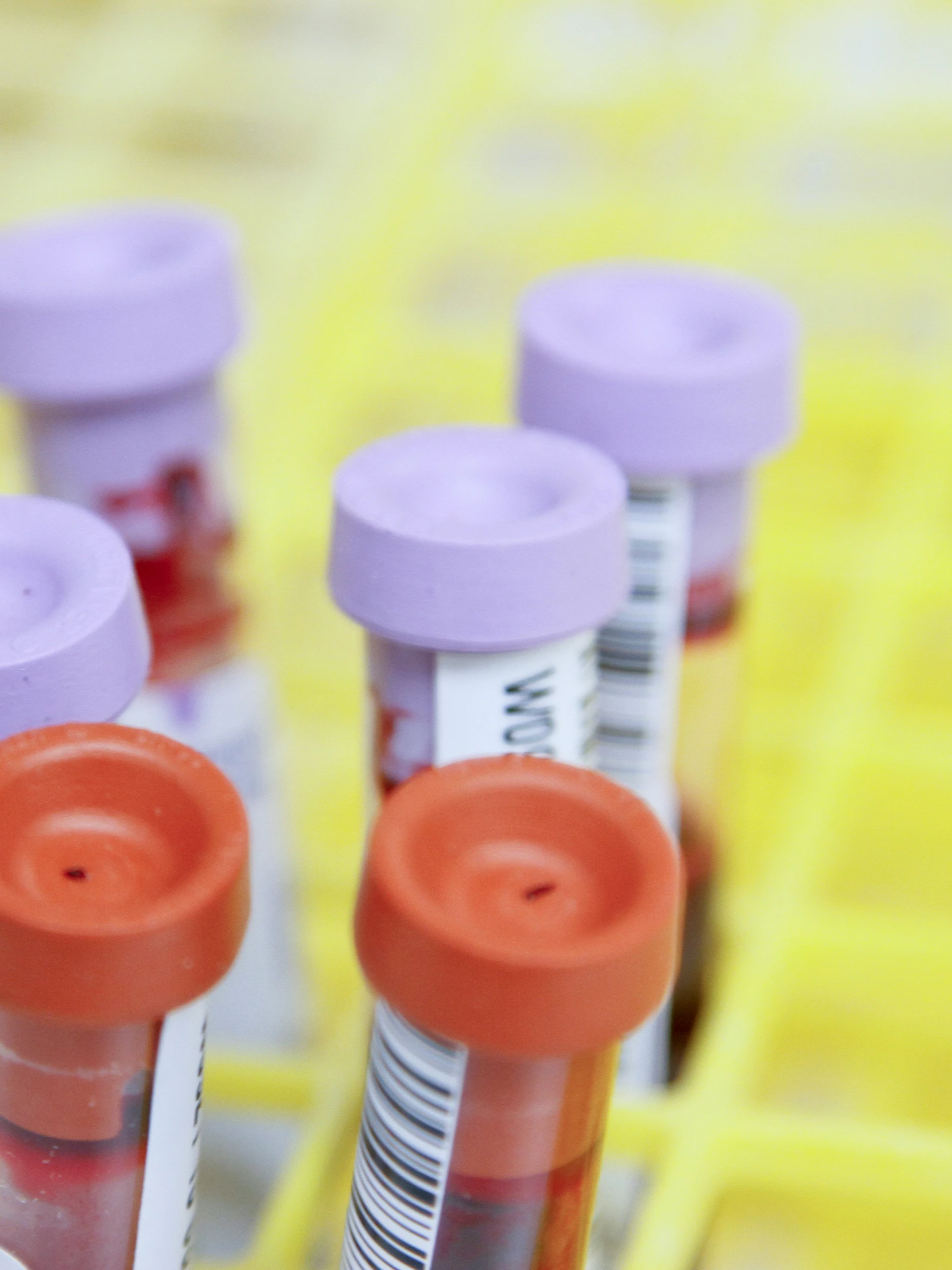 Hematologen op zoek naar de heilige graal