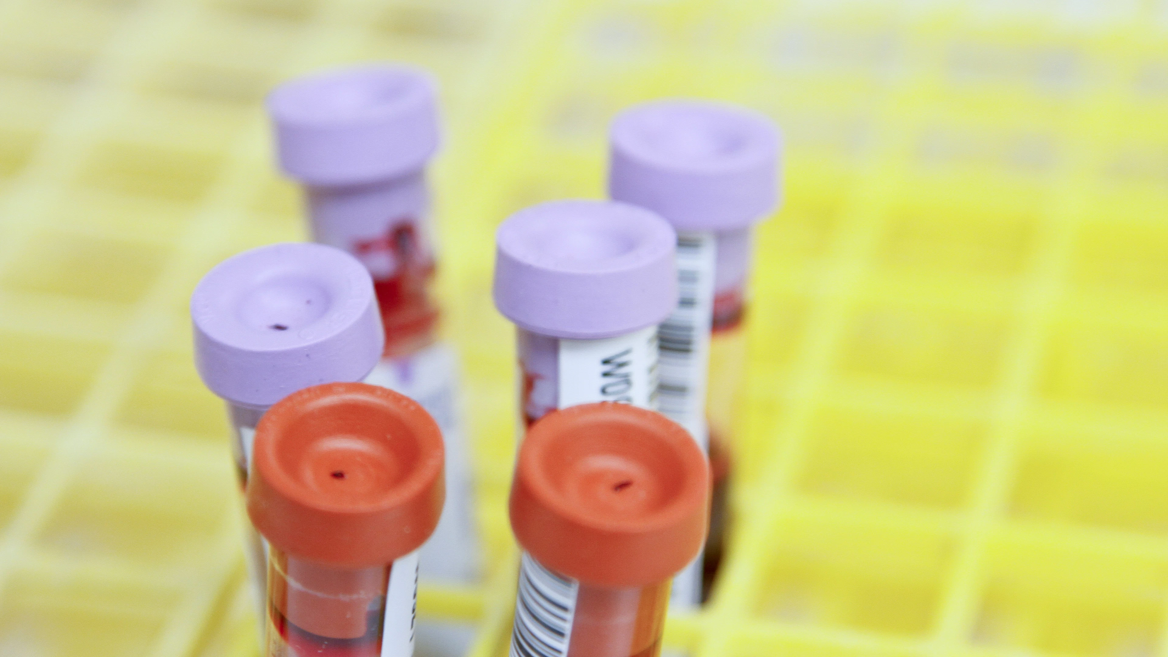 Hematologen op zoek naar de heilige graal