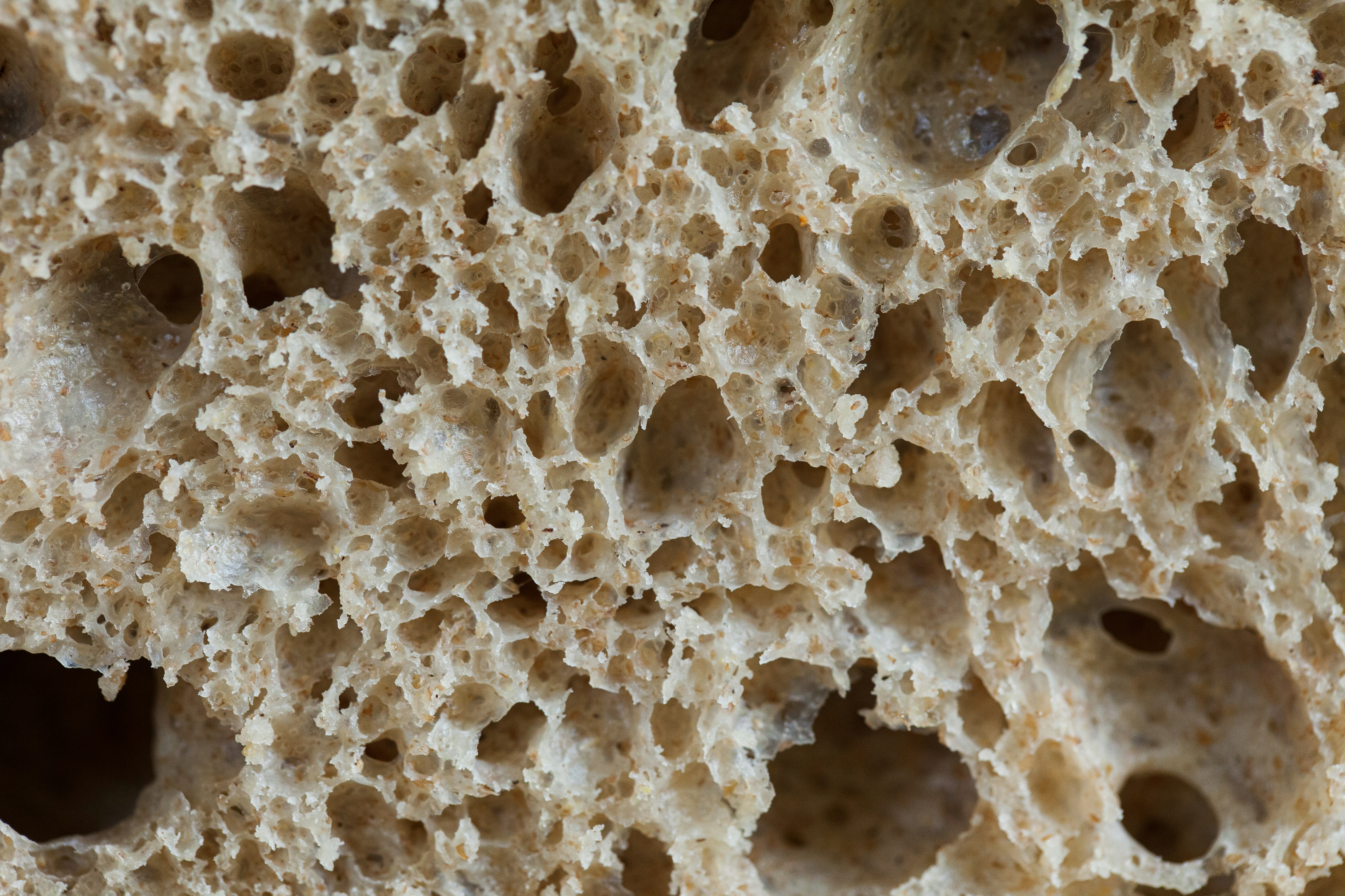 Is glutenintolerantie psychologisch?