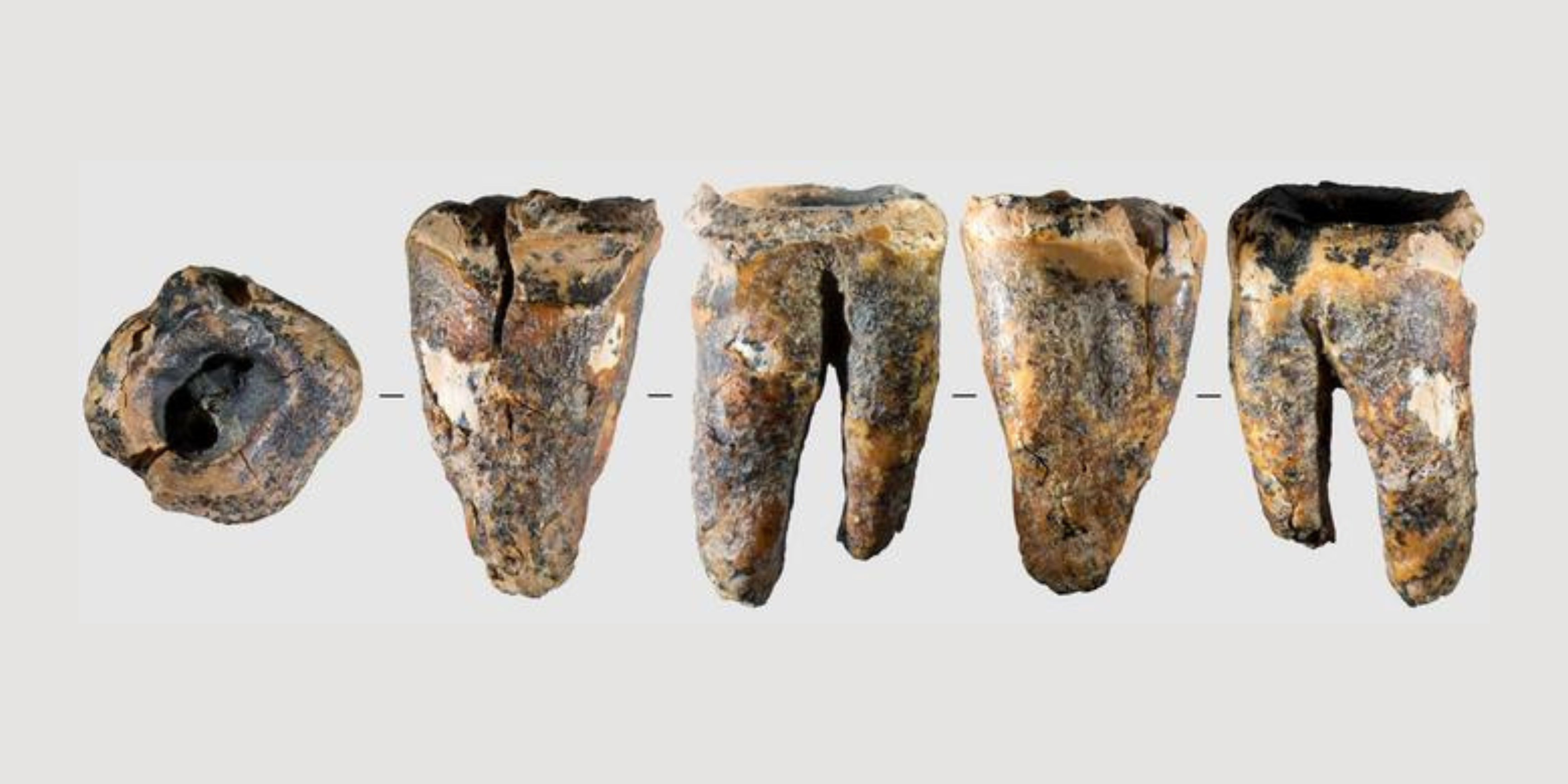 Neanderthalers gingen al naar de tandarts