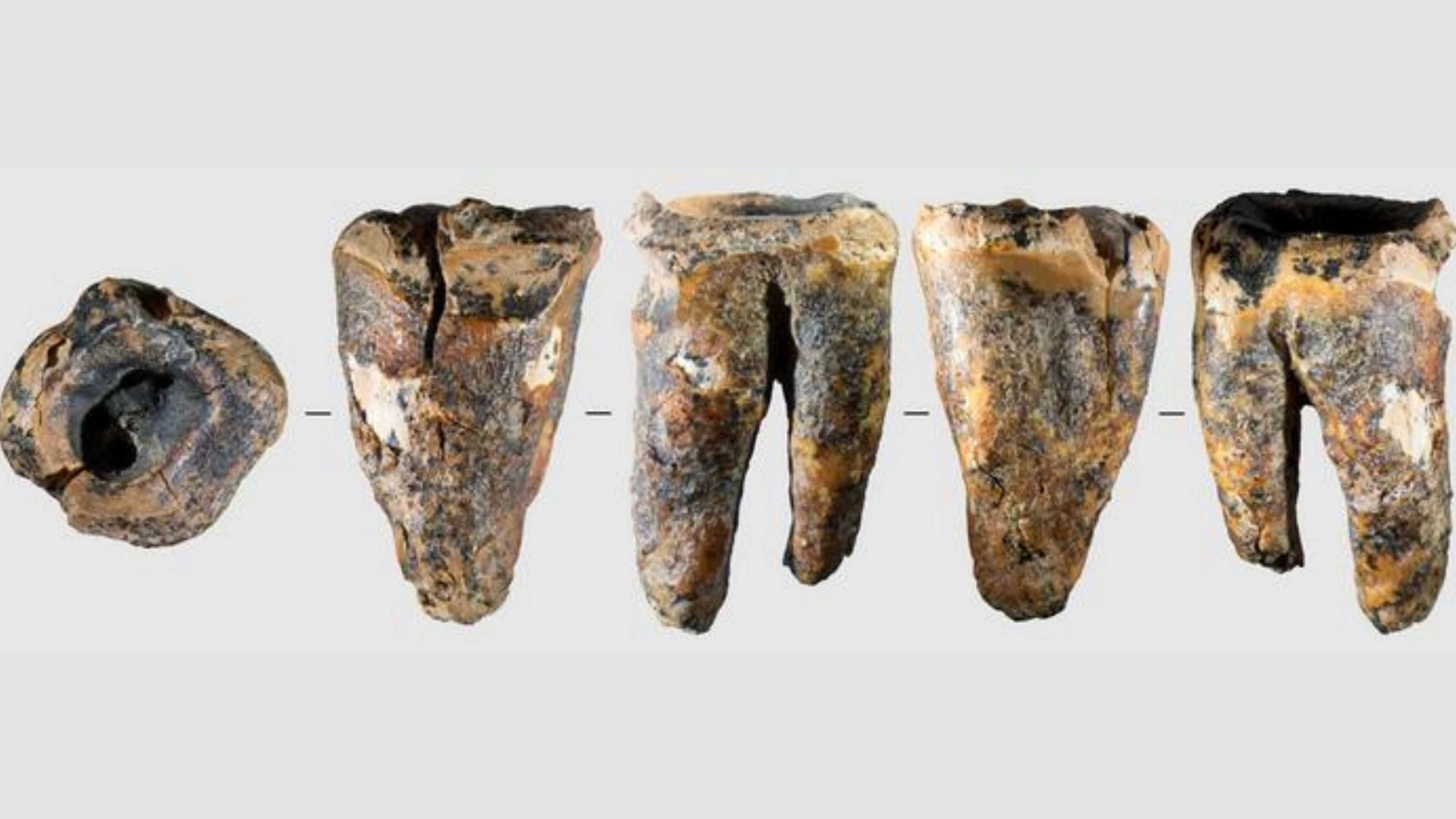 Neanderthalers gingen al naar de tandarts