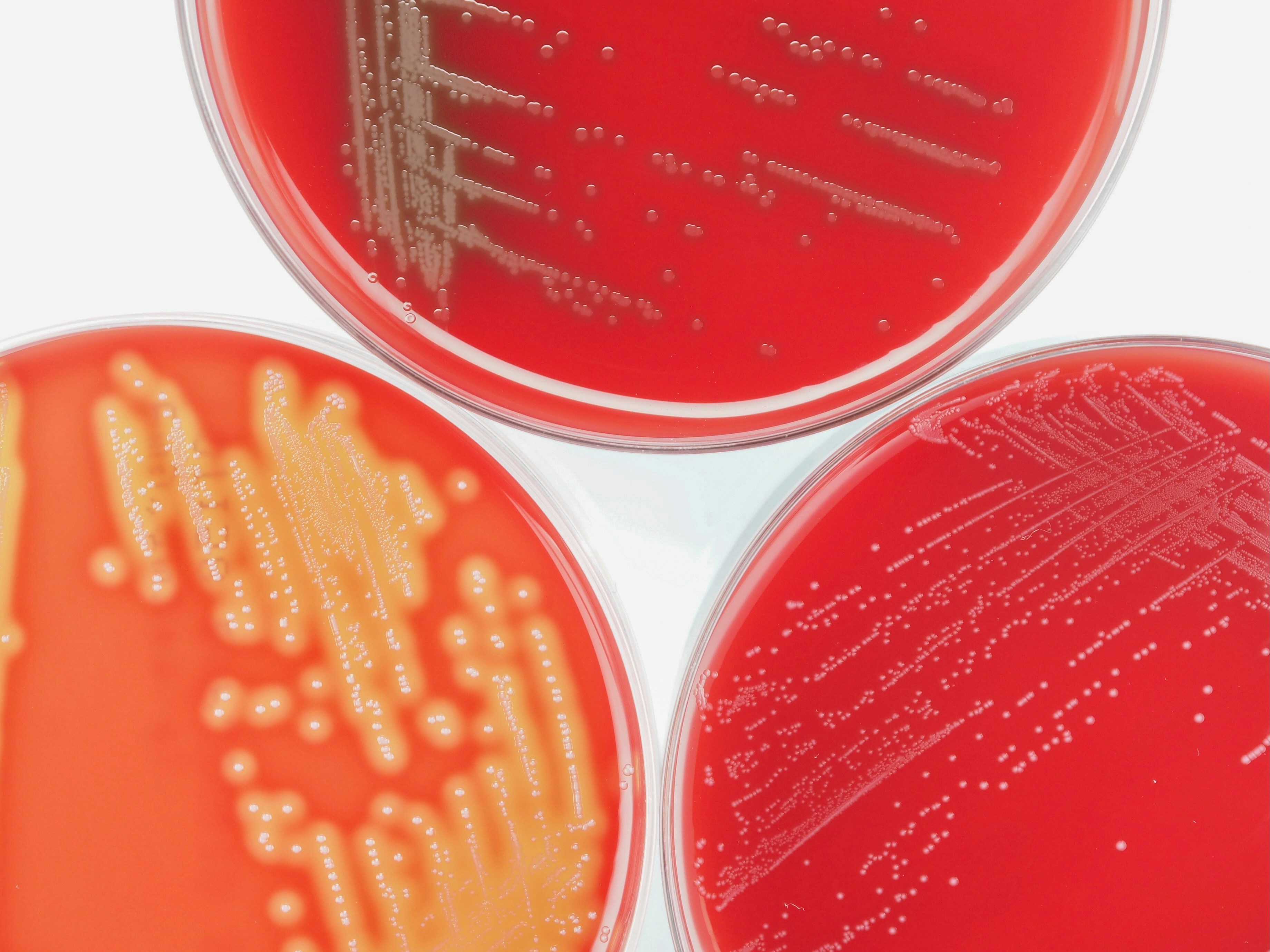Bacteriën verraden zichzelf door hun trillingen