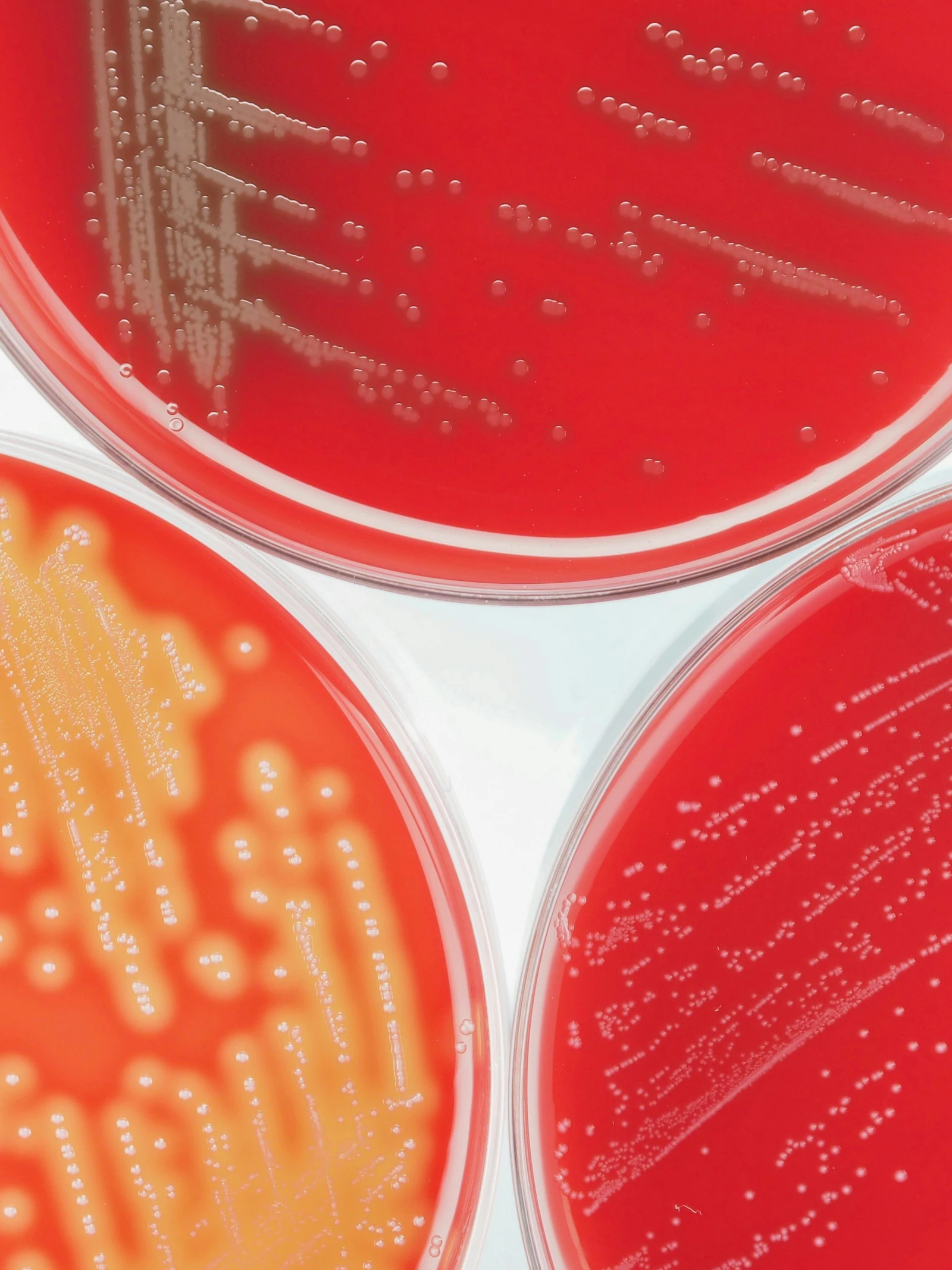 Bacteriën verraden zichzelf door hun trillingen