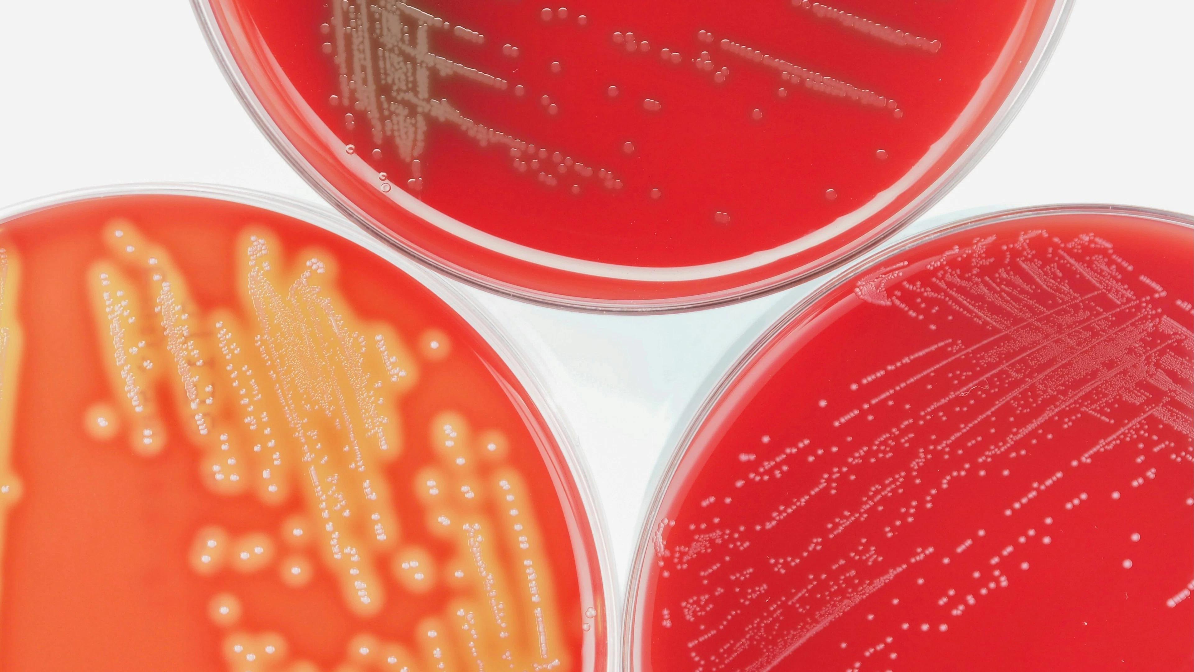 Bacteriën verraden zichzelf door hun trillingen