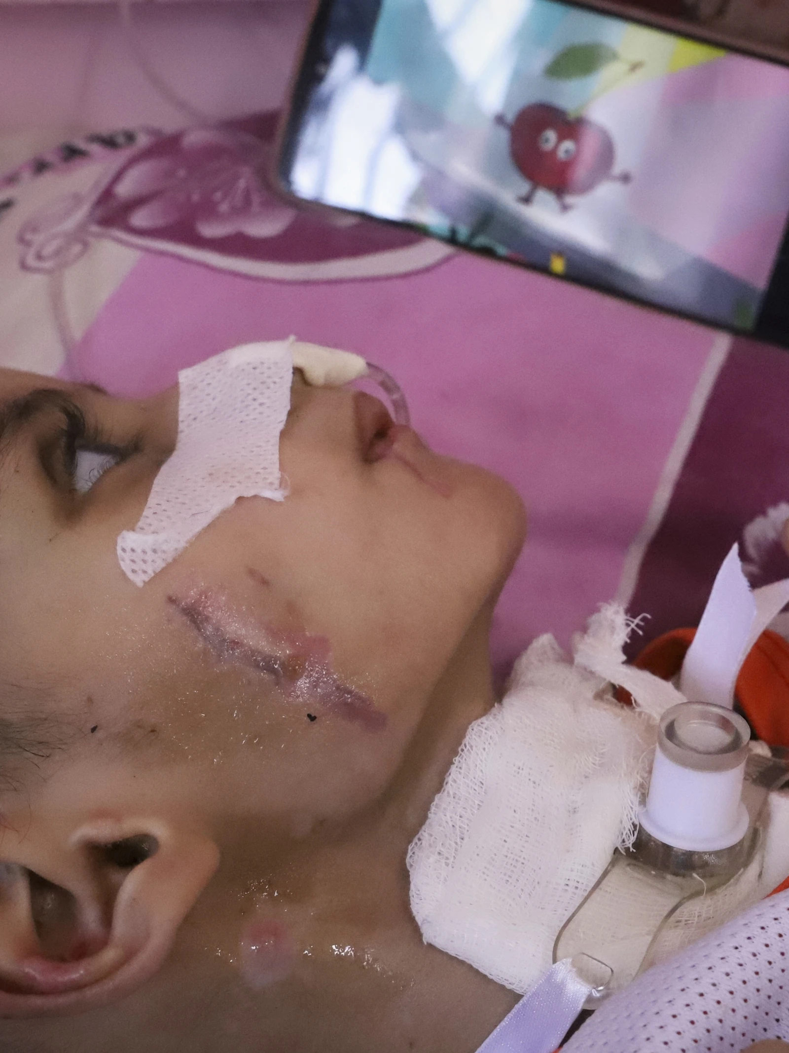 Oorlogsgeweld in het kinderbrein: wat Gaza ons leert over hersentrauma