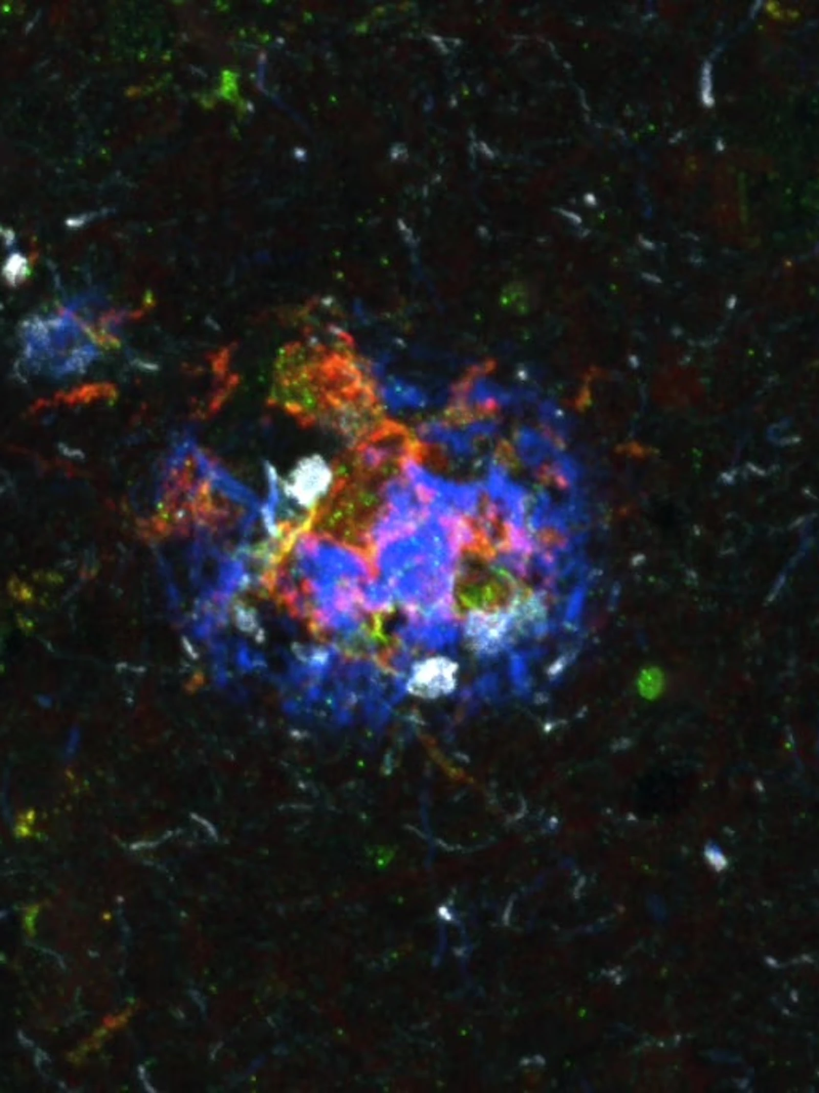 Hoe sommige breinen alzheimer weerstaan